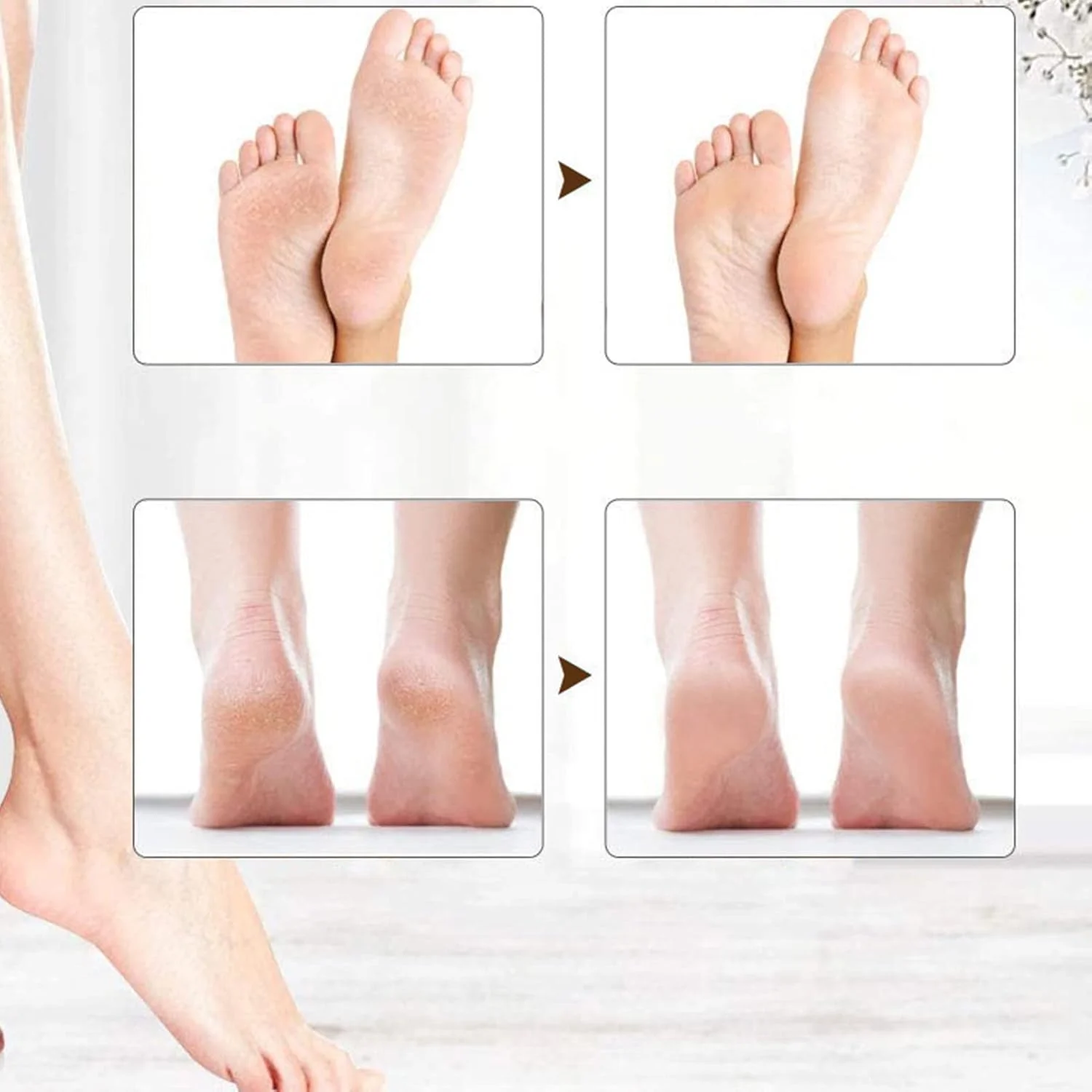 سوهان برقی پونگناس برای از بین بردن پینه پا، قابل شارژ، حرفه ای، قابل حمل، ابزار پدیکور با 2 درجه سرعت، کیت ابزار پدیکور مراقبت از پا برای پوست های مرده و پاشنه های ترک خورده سوهان برقی پونگناس برای از بین بردن پینه پا، قابل شارژ، حرفه ای، قابل حمل، ابزار پدیکور با 2 درجه سرعت، کیت ابزار پدیکور مراقبت از پا برای پوست های مرده و پاشنه های ترک خورده