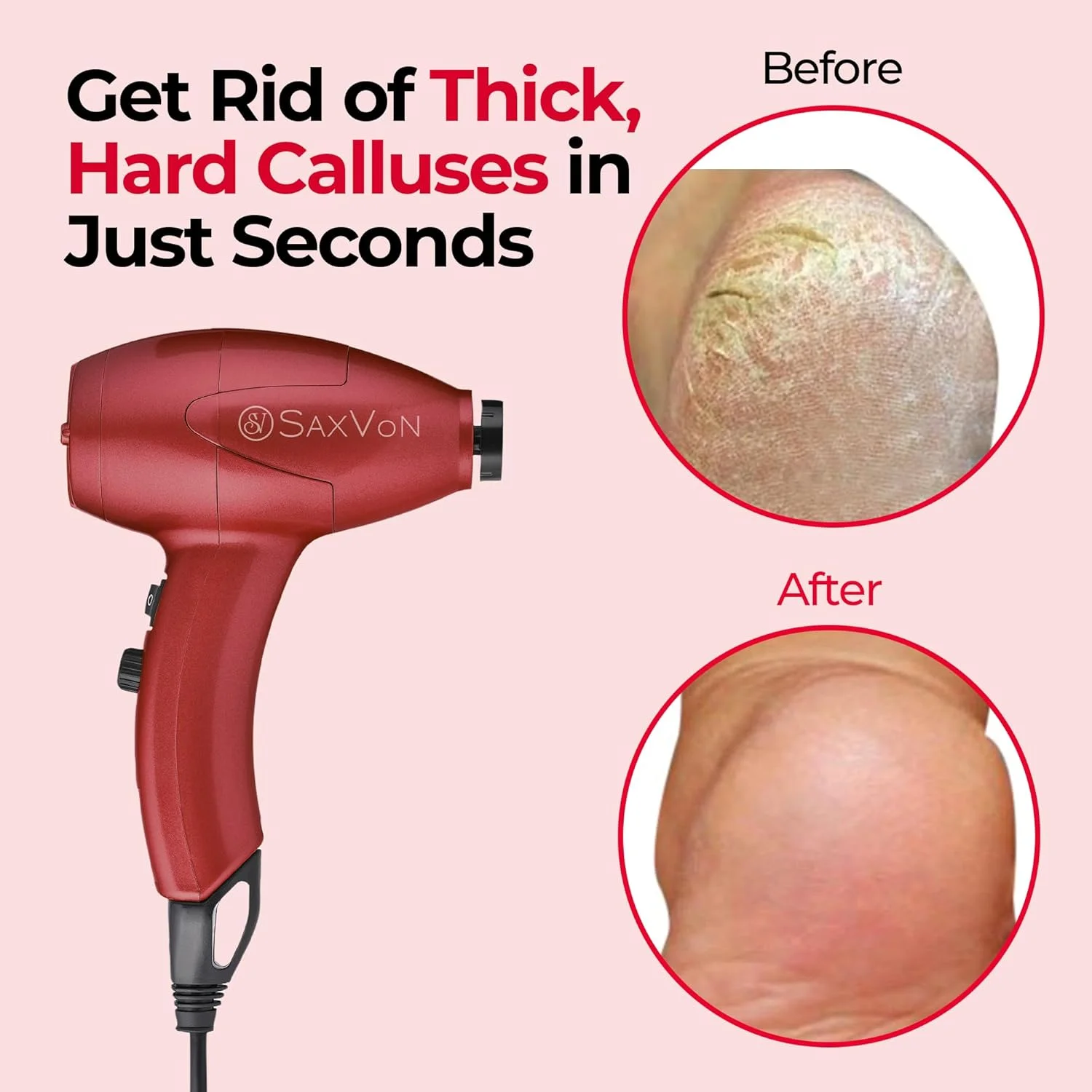 دستگاه از بین برنده پینه پا برقی SaxVon، سنگ پا دستگاه از بین برنده پینه پا برقی SaxVon، سنگ پا