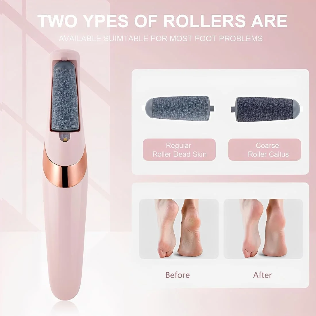 سوهان برقی پدیکور Tomdesk، ست پدیکور، مراقبت برقی پا، سوهان شارژی پا، ابزار پدیکور برای مراقبت از پوست های خشک و ترک خورده