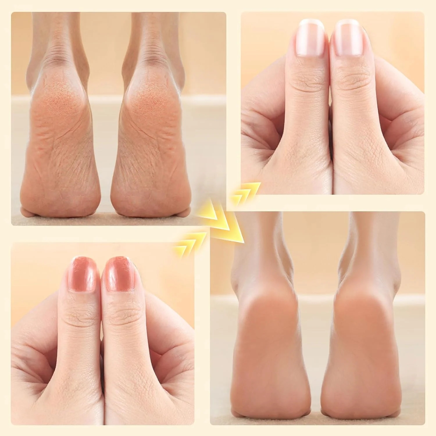 سوهان برقی قابل حمل پا و دریل ناخن SIYDYRIT - کیت پدیکور برقی شارژی 4 در 1 با سری های قابل تعویض دریل ناخن، آسیاب پا و ناخن با 3 سرعت قابل تنظیم، مشکی