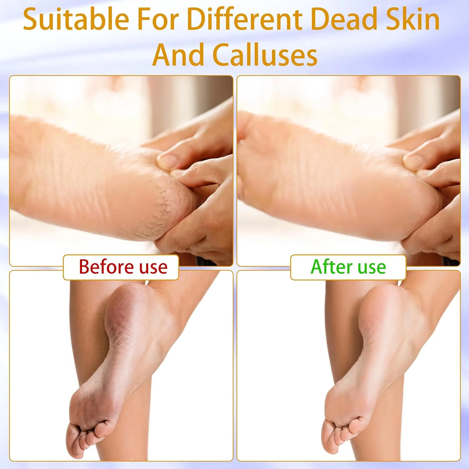 سوهان برقی پدیکور Whsdo - دارای 9 سرعت، سمباده پا به همراه دیسک های سمباده ای تعویضی، ابزار پدیکور و مانیکور شارژی و مناسب برای از بین بردن پوست های مرده، خشک، ترک خورده و پینه بسته