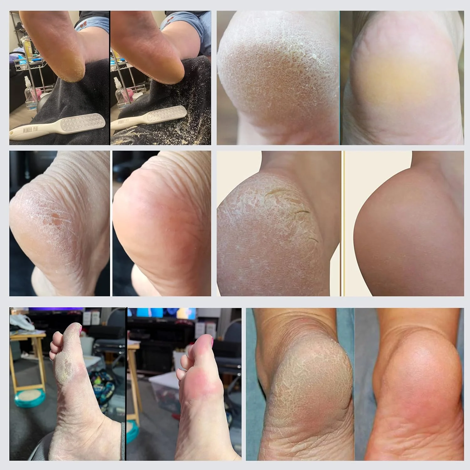 سوهان پدی واندر - رفع سریع پینه در سه دقیقه - سوهان پا - اسپری لایه بردار و نرم کننده فوری پا، سوهان پینه پاشنه پا - درمان پدیکور اسپا در خانه. (سوهان پا) سوهان پدی واندر - رفع سریع پینه در سه دقیقه - سوهان پا - اسپری لایه بردار و نرم کننده فوری پا، سوهان پینه پاشنه پا - درمان پدیکور اسپا در خانه. (سوهان پا)