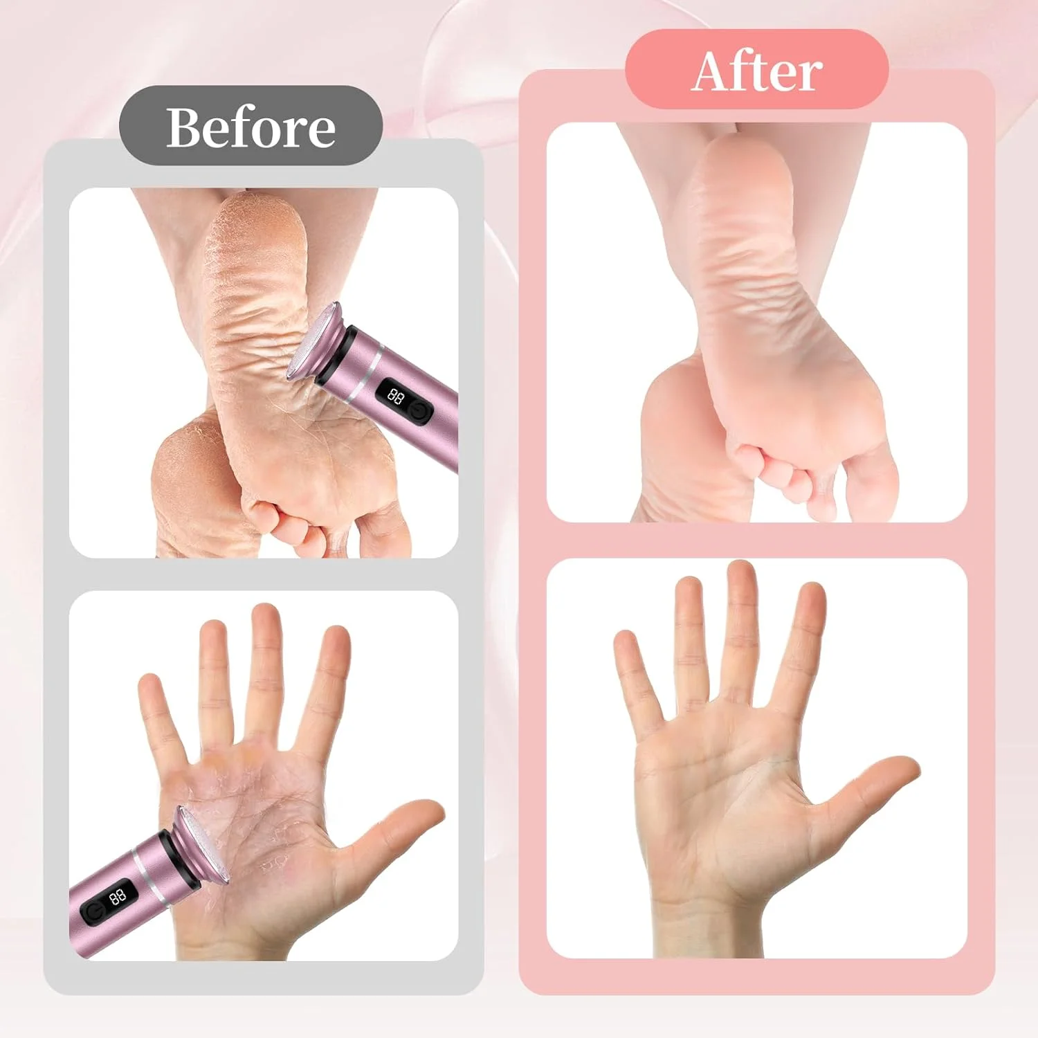 سوهان برقی پا یوتلیت، از بین برنده پوست سخت بدون سیم، ابزار حرفه ای پدیکور، سمباده برقی پا برای از بین بردن پوست مرده و پینه های ترک خورده