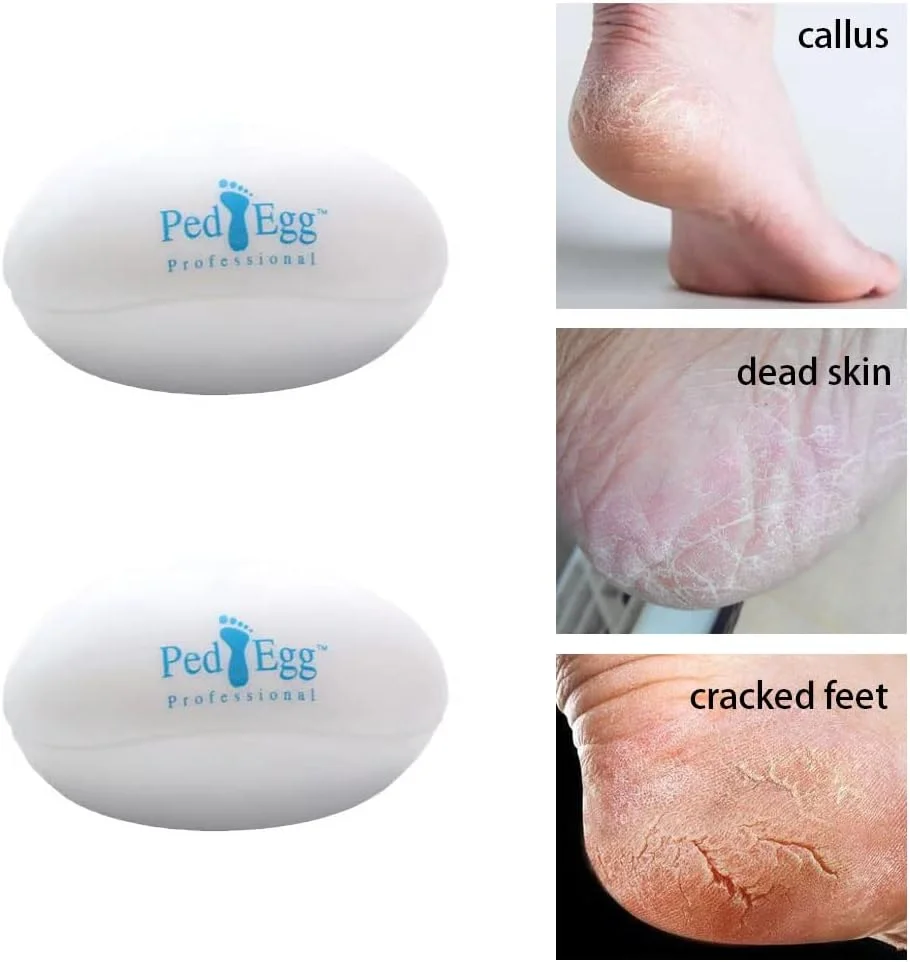 سوهان پا طرح تخم مرغی XINGYIYIJIA، ابزاری برای از بین بردن پوست های مرده و پینه پا