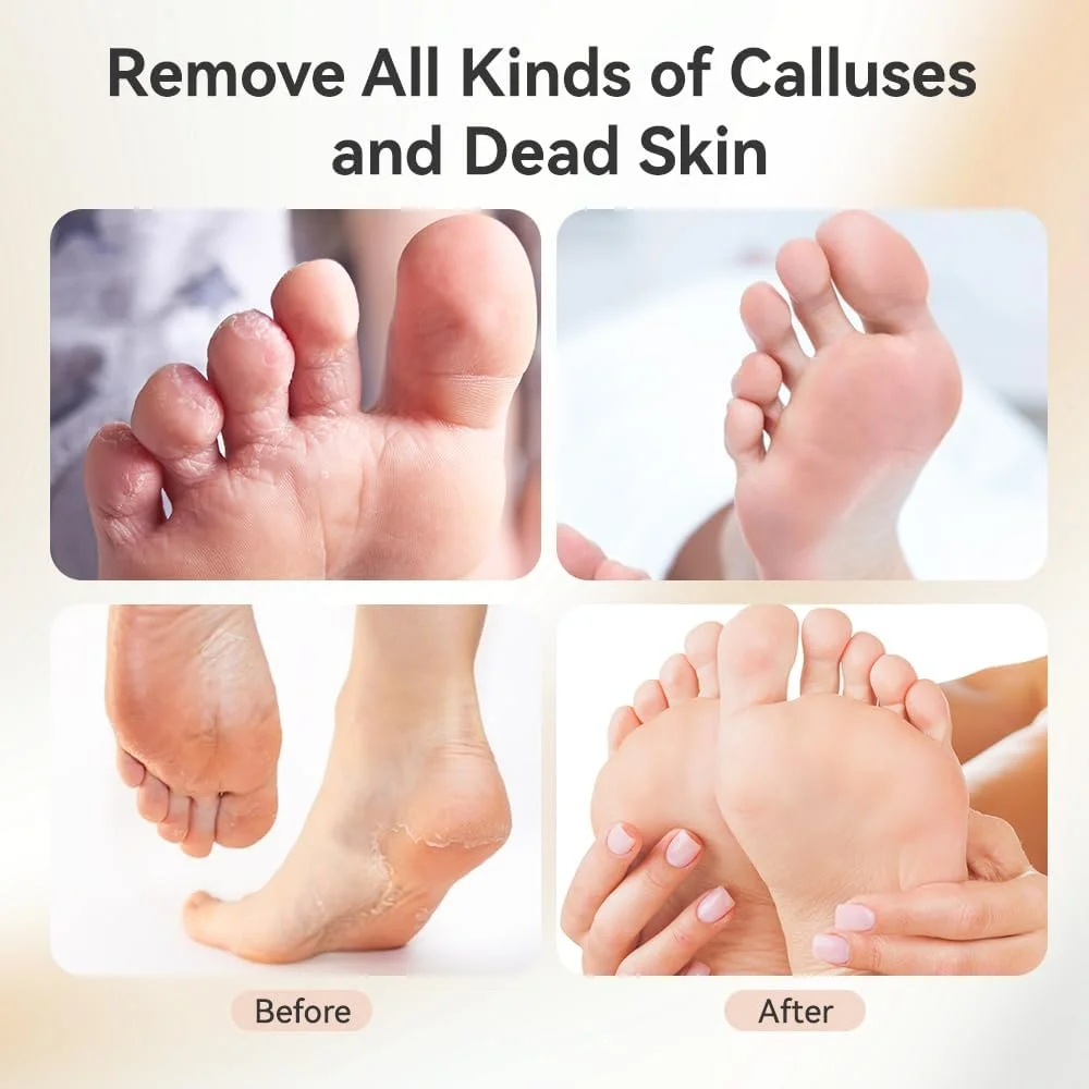سوهان برقی پینه پا YUNRUO، 2 در 1، دارای 9 سرعت، ابزار پدیکور پا، ابزار سنگ پای سمباده ای جایگزین برای پوست مرده (رزگلد) سوهان برقی پینه پا YUNRUO، 2 در 1، دارای 9 سرعت، ابزار پدیکور پا، ابزار سنگ پای سمباده ای جایگزین برای پوست مرده (رزگلد)