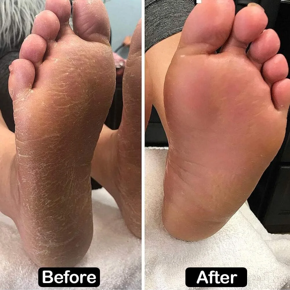 دستگاه الکتریکی از بین برنده پینه پا ونکستک با سرعت قابل تنظیم به همراه 60 عدد دیسک سمباده ای قابل تعویض (طلایی)