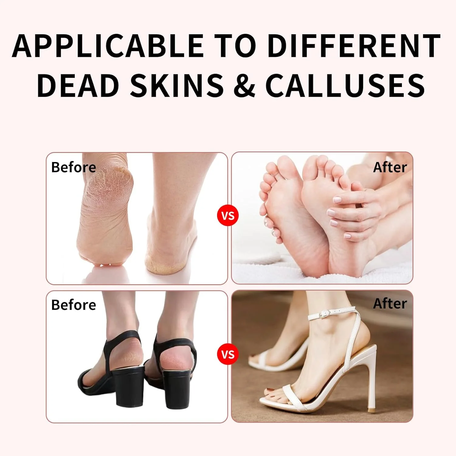 سوهان برقی پدیکور توروکو، سوهان پا با سرعت قابل تنظیم برای از بین بردن پوست مرده و پاشنه های ترک خورده، ابزار حرفه ای پدیکور با 60 عدد دیسک سمباده، مراقبت بدون درد پا برای آقایان و بانوان (صورتی) سوهان برقی پدیکور توروکو، سوهان پا با سرعت قابل تنظیم برای از بین بردن پوست مرده و پاشنه های ترک خورده، ابزار حرفه ای پدیکور با 60 عدد دیسک سمباده، مراقبت بدون درد پا برای آقایان و بانوان (صورتی)