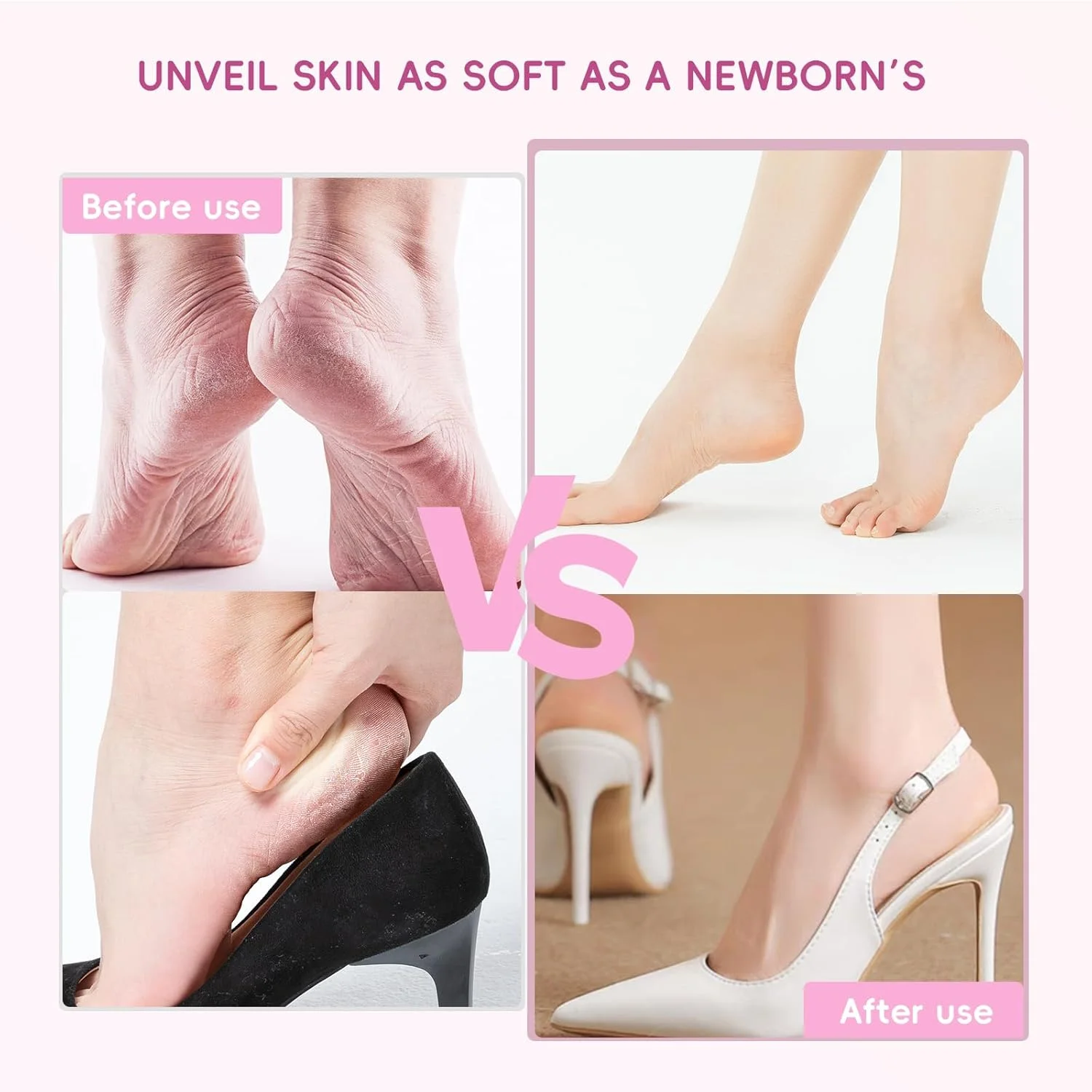 سوهان برقی پدیکور پا - سوهان برقی بی سیم پا با 9 تنظیم سرعت، شارژ Type-C، ابزار پدیکور برای پوست مرده - صورتی