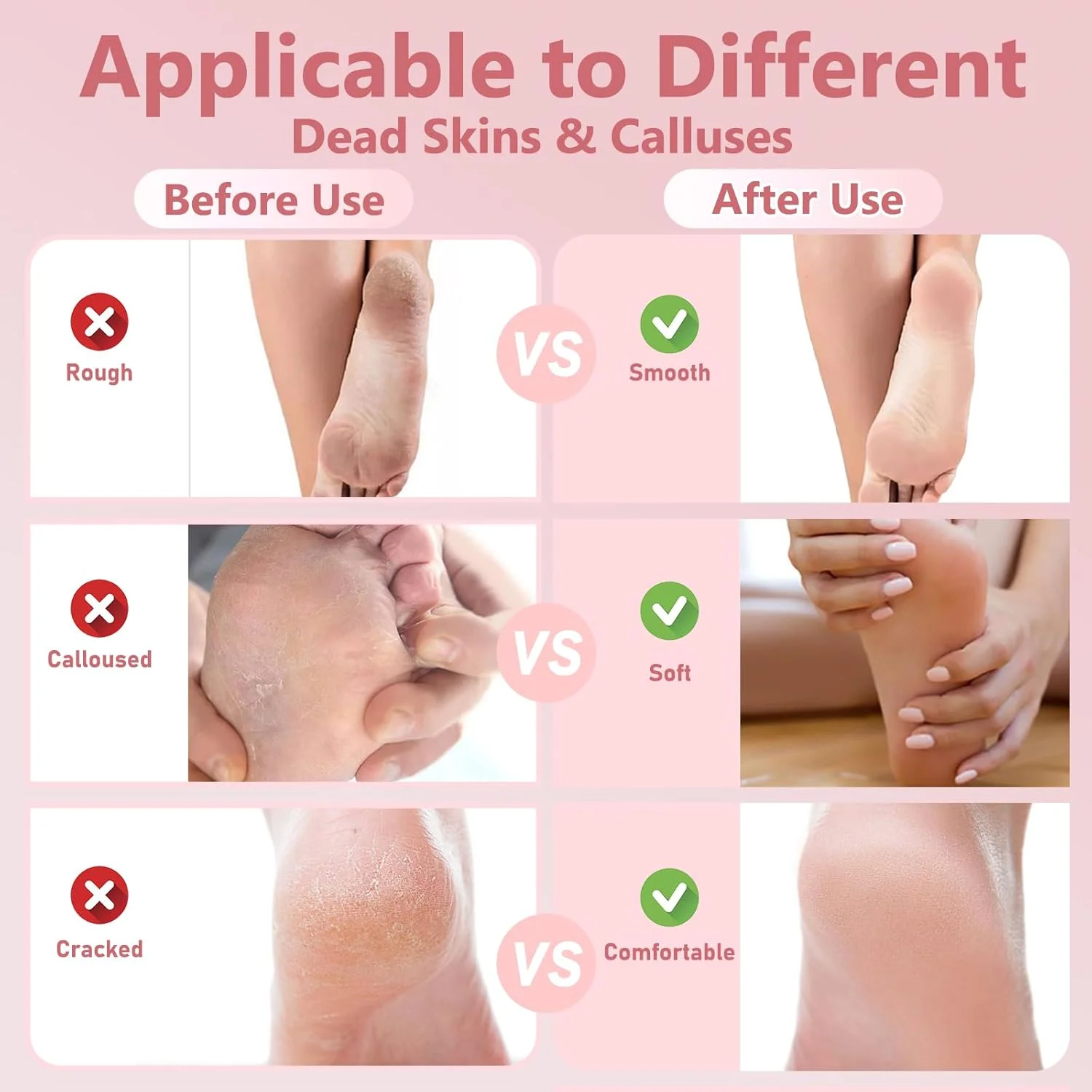 سوهان برقی پا VINGVO، قابل حمل با USB، از بین برنده پینه، چرخش 360 درجه، سرعت قابل تنظیم، اسکرابر پا با 60 عدد کاغذ سنباده تعویضی (صورتی) سوهان برقی پا VINGVO، قابل حمل با USB، از بین برنده پینه، چرخش 360 درجه، سرعت قابل تنظیم، اسکرابر پا با 60 عدد کاغذ سنباده تعویضی (صورتی)