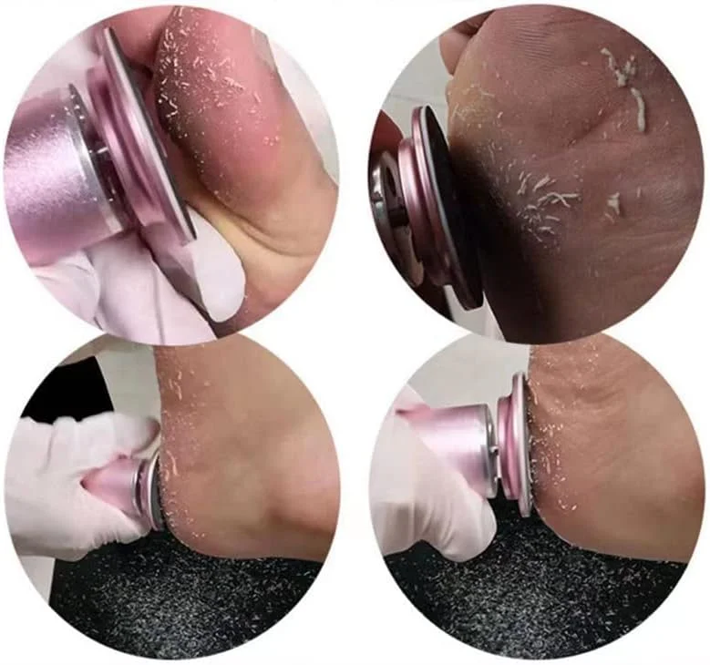 سوهان برقی پدیکور پا TTEDOYE، دستگاه سنگ پای برقی برای از بین بردن پینه پا، دستگاه پدیکور برقی پا، دستگاه از بین برنده پینه پا