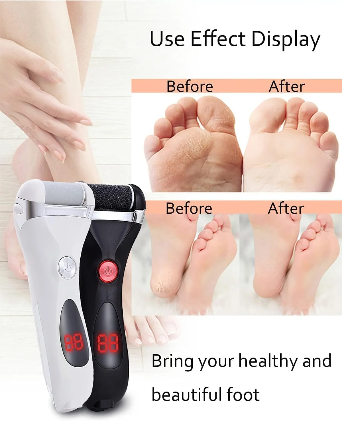 سوهان برقی پا SYOSI برای پوست سخت، قابل شارژ USB، ضد آب، از بین برنده پینه با 3 غلتک سنگ پا و ست اسکراپر پا 10 در 1، مراقبت از پا برای پاشنه ترک خورده خشک سوهان برقی پا SYOSI برای پوست سخت، قابل شارژ USB، ضد آب، از بین برنده پینه با 3 غلتک سنگ پا و ست اسکراپر پا 10 در 1، مراقبت از پا برای پاشنه ترک خورده خشک