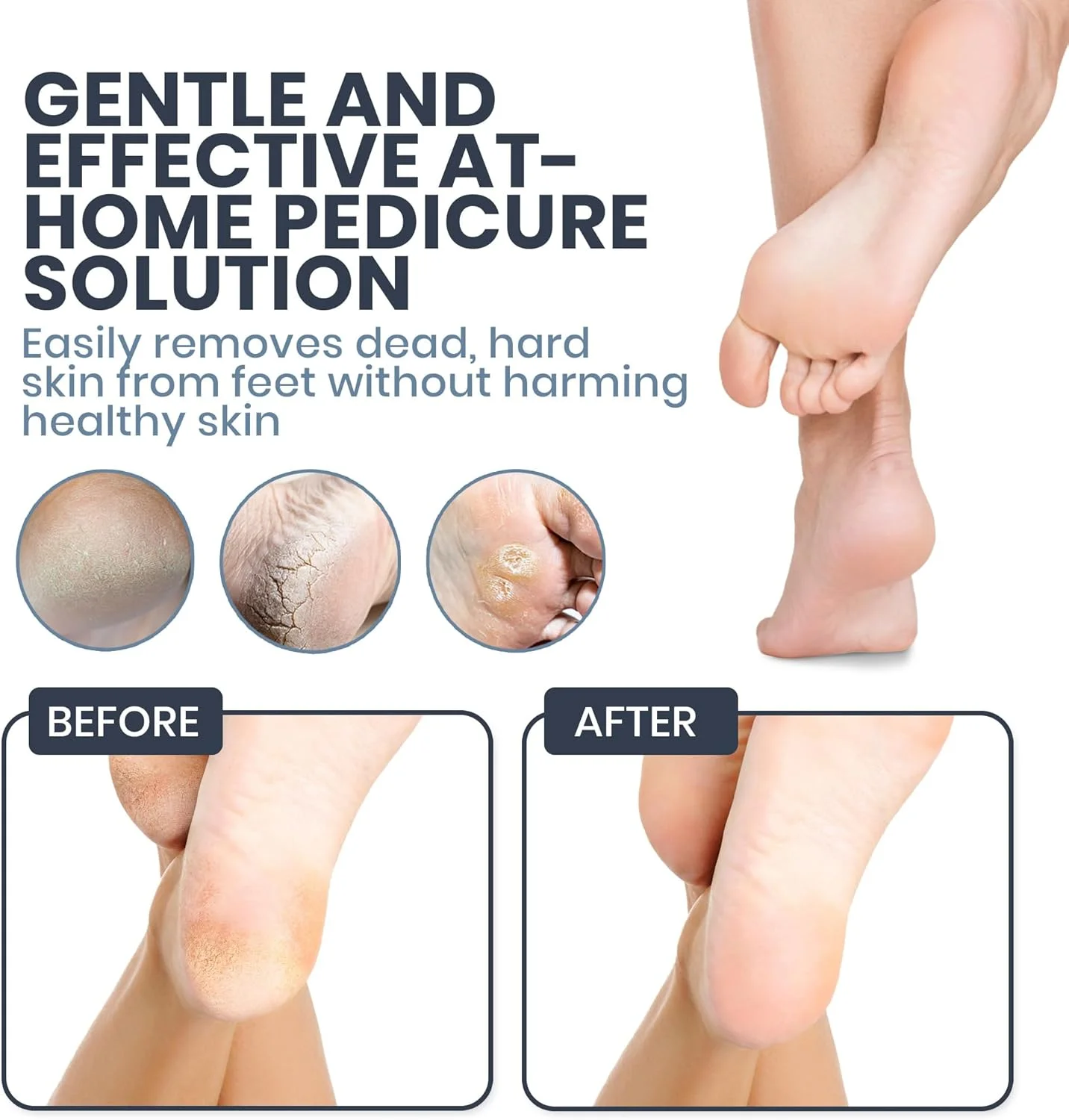 سوهان برقی پا SoleLux - از بین برنده پینه با سرعت قابل تنظیم، 60 پد سمباده، و لایه برداری حرفه ای پوست مرده برای پاهای سفت، ترک خورده و خشک - ابزار اسپا پدیکور خانگی برای آقایان و بانوان (صورتی)