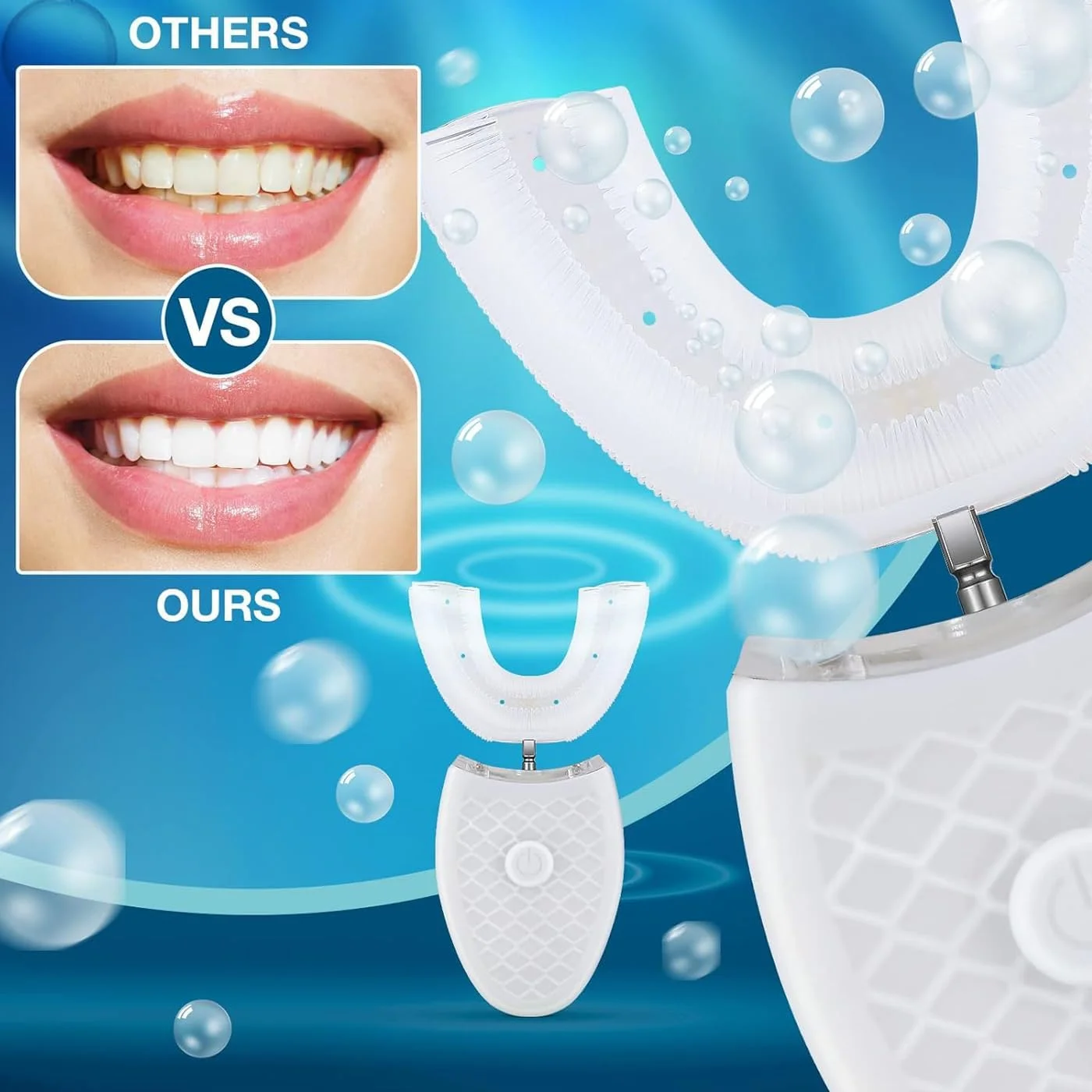 مسواک برقی اتوماتیک U شکل NITU | تمیز کردن سریع 360 درجه کل دهان با لرزش صوتی و سفید کننده نور آبی | پاک کننده دهان قابل شارژ بدون دست برای کودکان و بزرگسالان + نازل اضافی رایگان