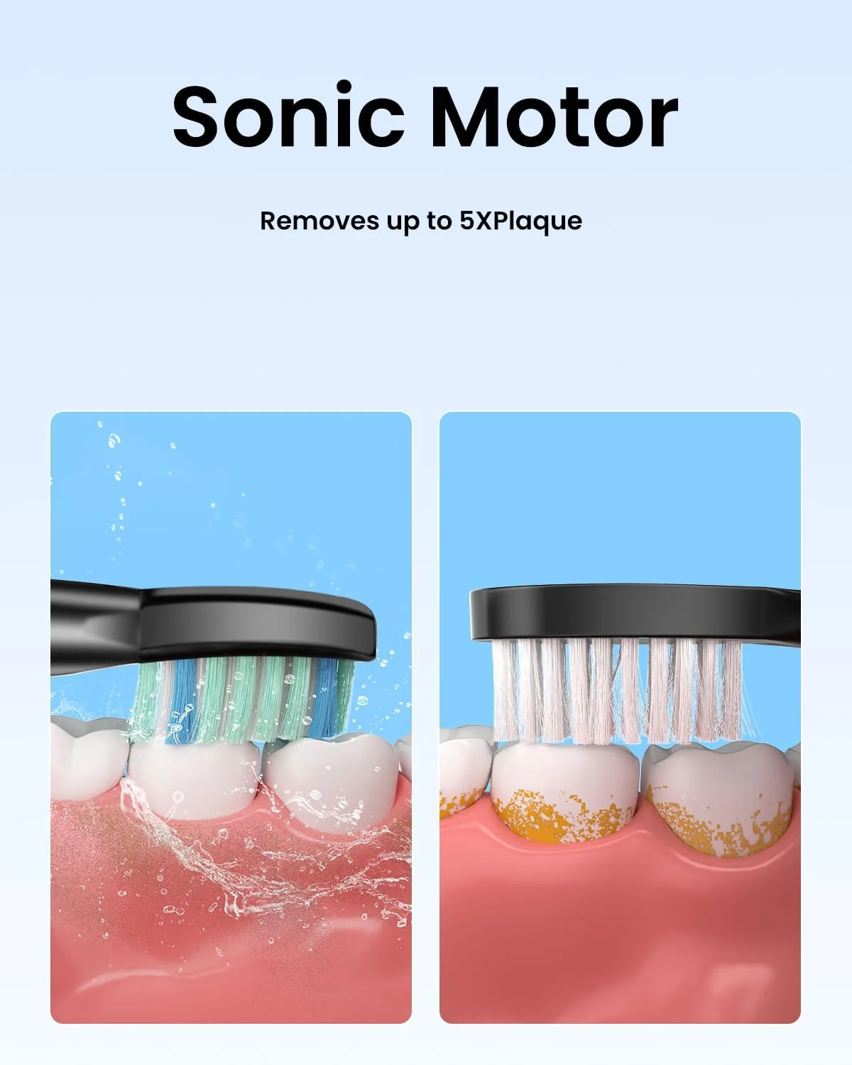 مسواک برقی بزرگسالان Rtauys، دارای 8 سری مسواک و کیف مسافرتی، 5 حالت با تایمر هوشمند 2 دقیقه ای داخلی، یک بار شارژ برای 60 روز، موتور 41000 VPM (مشکی)