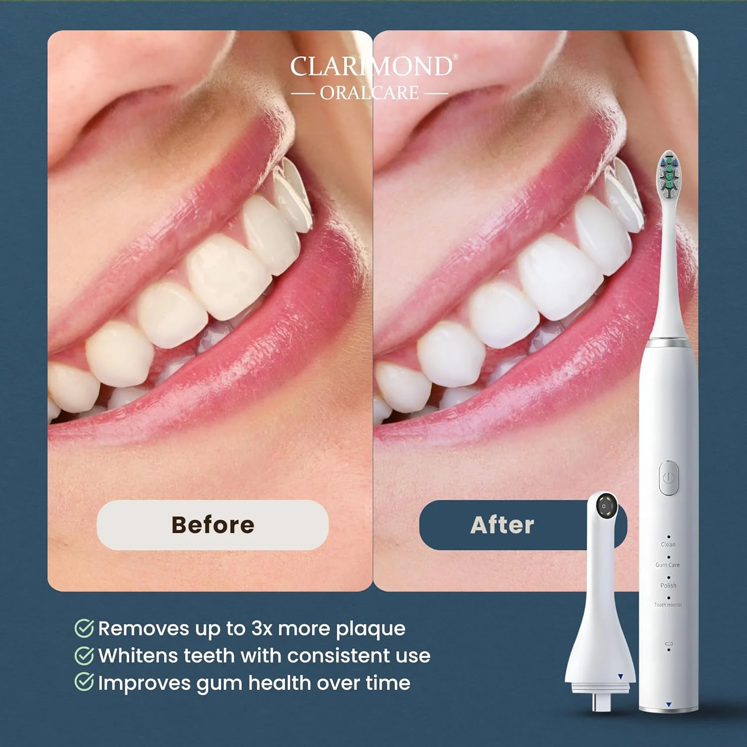 Clarimond White Ultimate Edition Advanced Deep Clean Electric Toothbrush with HD Camera, Type-C Charging, IPX7 Waterproof, Long Battery Life, Smart Timer, Multiple Modes, 3 Dupont Brush Heads Clarimond White Ultimate Edition Advanced Deep Clean Electric Toothbrush with HD Camera, Type-C Charging, IPX7 Waterproof, Long Battery Life, Smart Timer, Multiple Modes, 3 Dupont Brush Heads