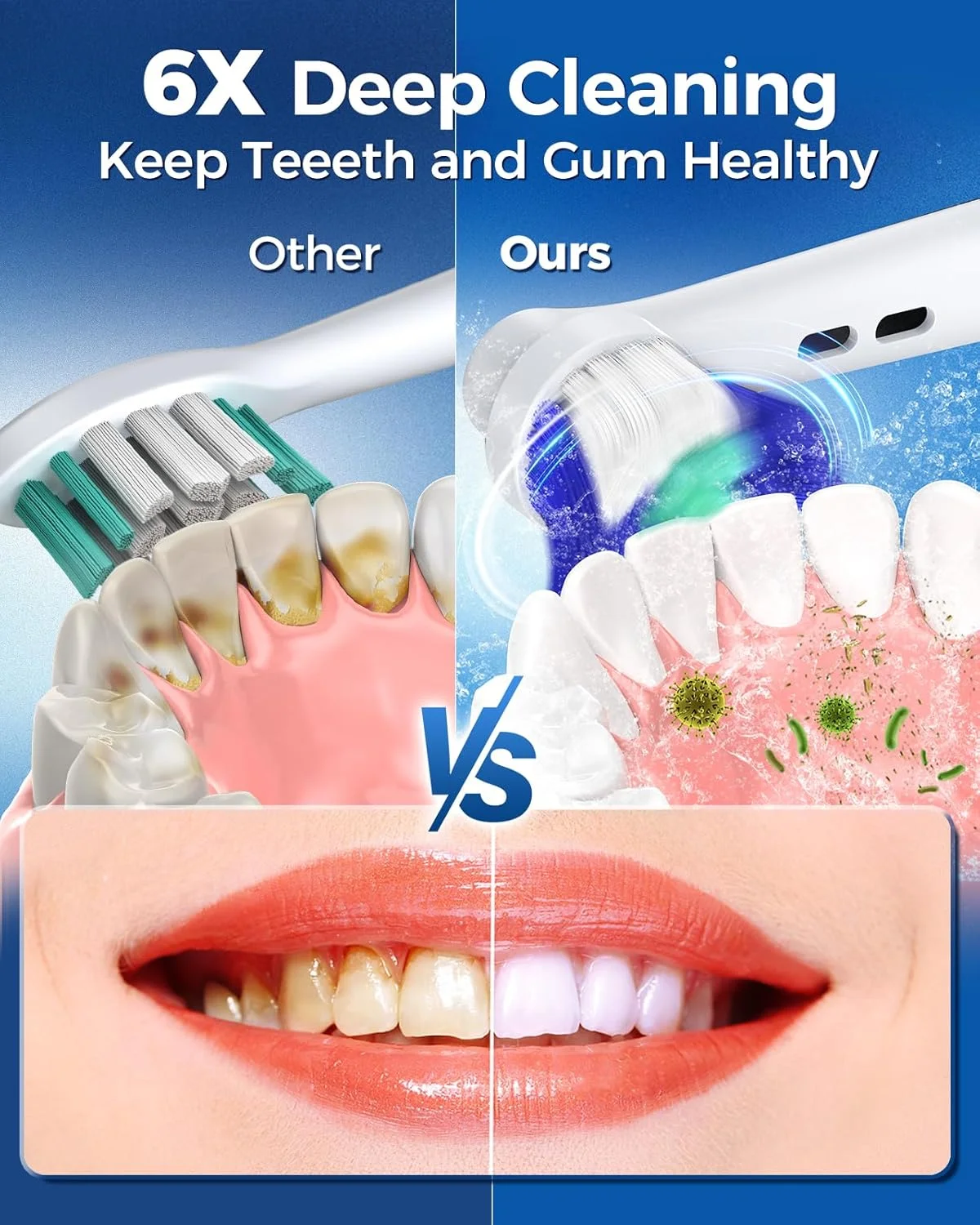 مسواک برقی چرخشی TEETHEORY برای بزرگسالان با 8 سری (2 نوع)، مسواک برقی 4 حالته با قابلیت شارژ و تایمر هوشمند 2 دقیقه ای - آبی آسمانی مسواک برقی چرخشی TEETHEORY برای بزرگسالان با 8 سری (2 نوع)، مسواک برقی 4 حالته با قابلیت شارژ و تایمر هوشمند 2 دقیقه ای - آبی آسمانی