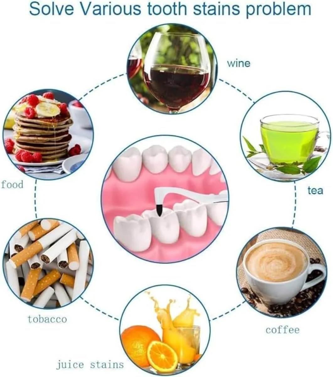 دستگاه پولیش دندان چرخشی Spin Smile 360، سفید کننده و از بین برنده جرم دندان، مراقبت حرفه ای دندان در خانه برای داشتن دندان هایی روشن تر و سالم تر / دارای چراغ LED و 4 سری پولیش دستگاه پولیش دندان چرخشی Spin Smile 360، سفید کننده و از بین برنده جرم دندان، مراقبت حرفه ای دندان در خانه برای داشتن دندان هایی روشن تر و سالم تر / دارای چراغ LED و 4 سری پولیش