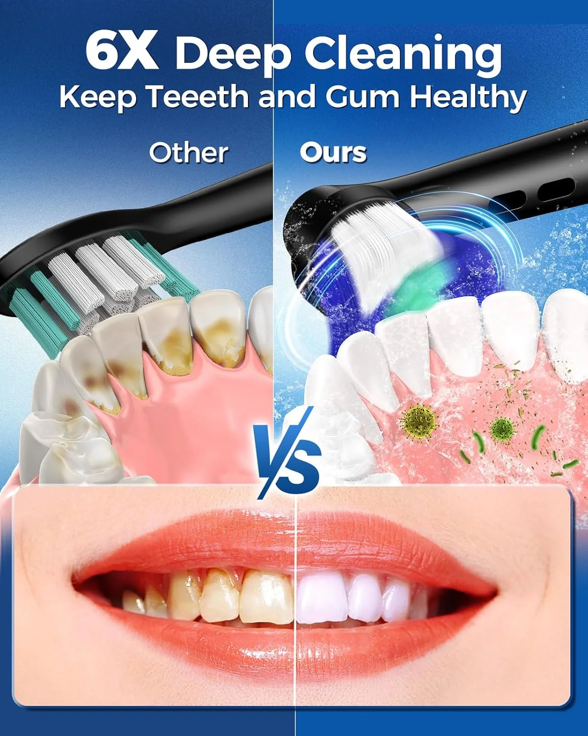 مسواک برقی چرخشی بزرگسالان با 8 سری (2 نوع)، مسواک برقی با 4 حالت تمیزکننده عمیق با قابلیت شارژ و تایمر هوشمند 2 دقیقه ای مسواک برقی چرخشی بزرگسالان با 8 سری (2 نوع)، مسواک برقی با 4 حالت تمیزکننده عمیق با قابلیت شارژ و تایمر هوشمند 2 دقیقه ای