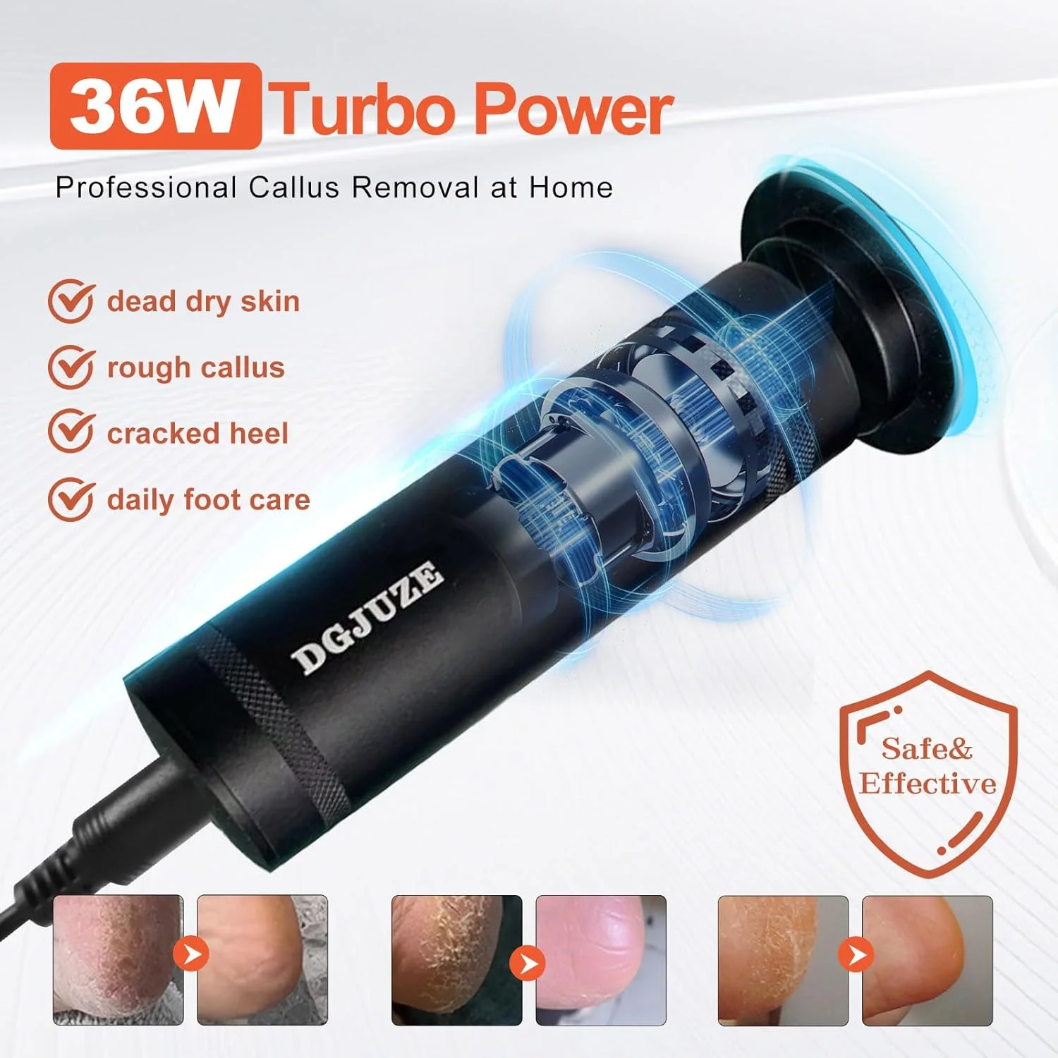 سوهان برقی حرفه ای پا - سوهان فلزی پا با سرعت قابل تنظیم 1200 دور در دقیقه برای از بین بردن پوست مرده، حذف خودکار پینه با دیسک های سمباده ای جایگزین برای ابزار پدیکور پا زنانه و مردانه (مشکی)