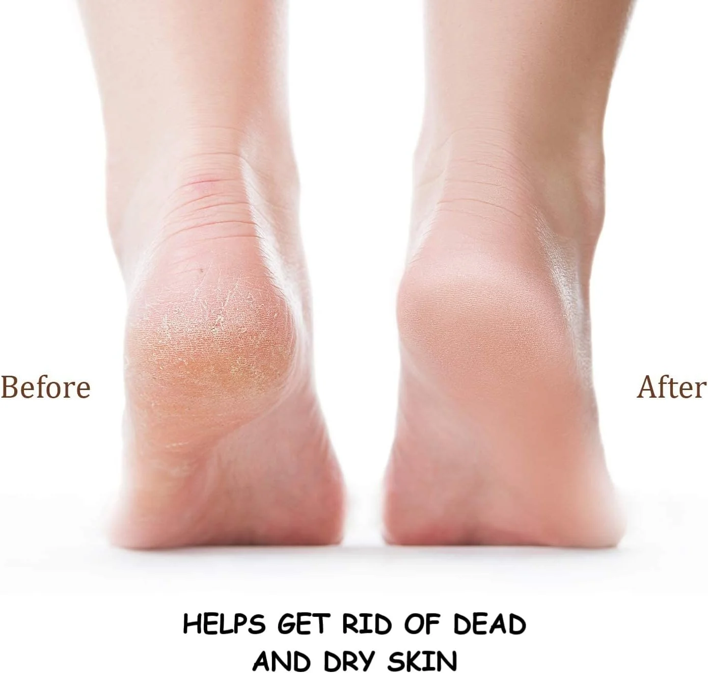 پدهای برچسب جایگزین سوهان پا حرفه ای، از بین برنده پینه و لایه بردار (دانه بندی 180، 100 عدد)