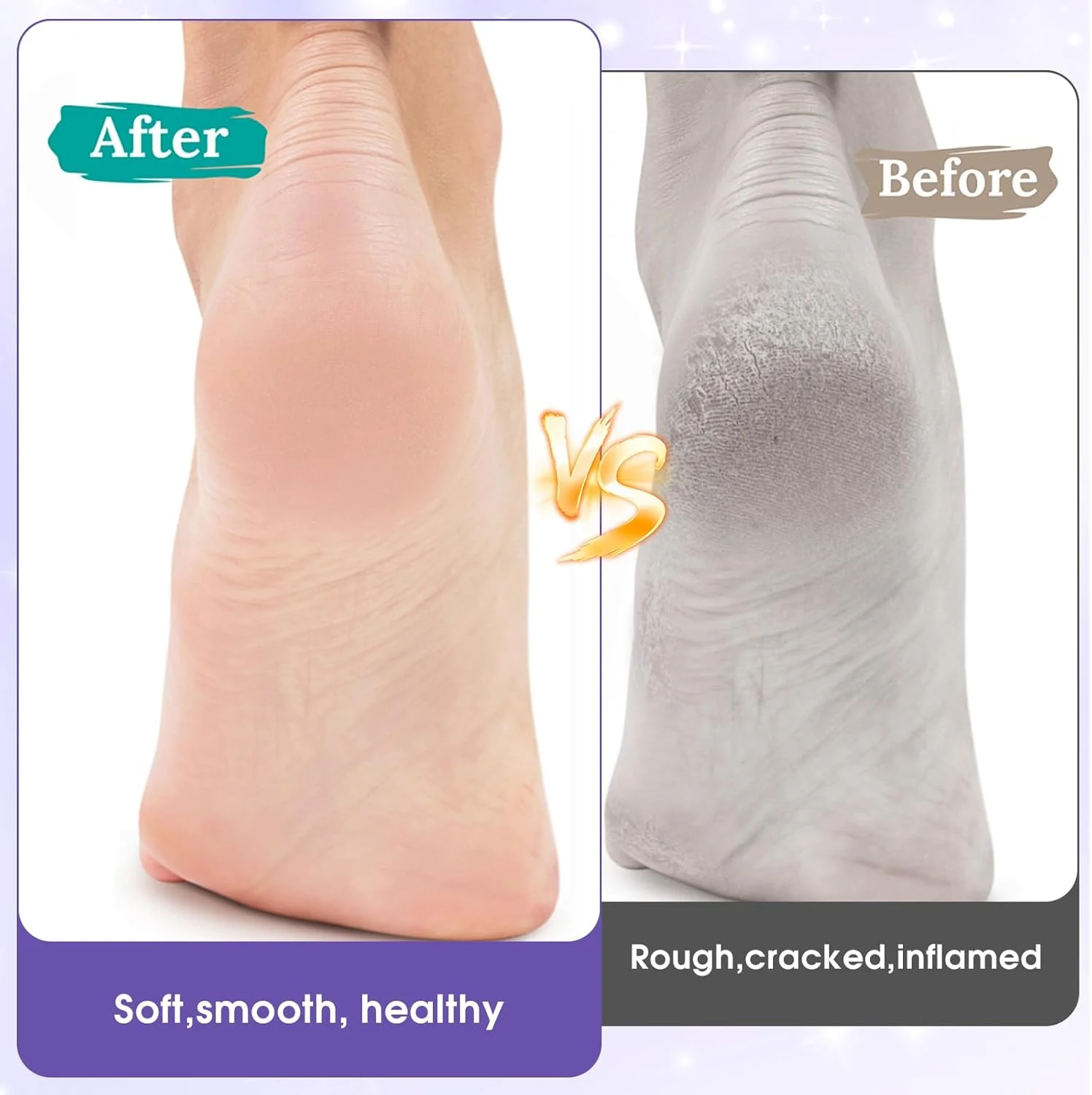 مجموعه 120 عددی دیسک سمباده پدیکور، کاغذ سمباده 25 میلی متری سنگ پای برقی با درجه زبری 80/120/180/240 به همراه سری فلزی، سمباده یدکی، سری های اتصال دستگاه برش ناخن پا