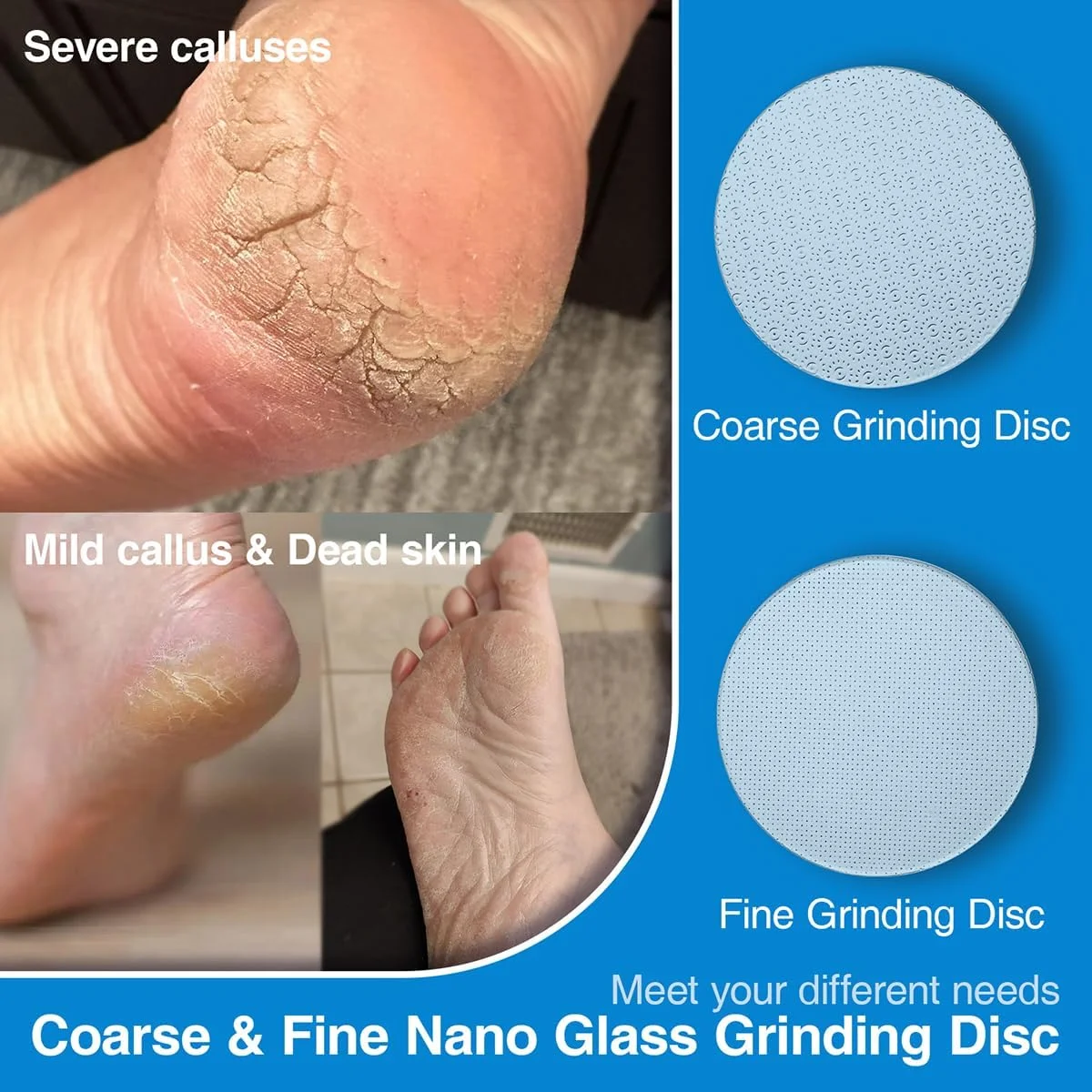 OZLICE 2 عدد دیسک سنگ زنی شیشه ای نانو برای دستگاه از بین برنده پینه برقی پا Dermave به همراه 60 عدد پد چسبی دو طرفه گرد قابل تعویض