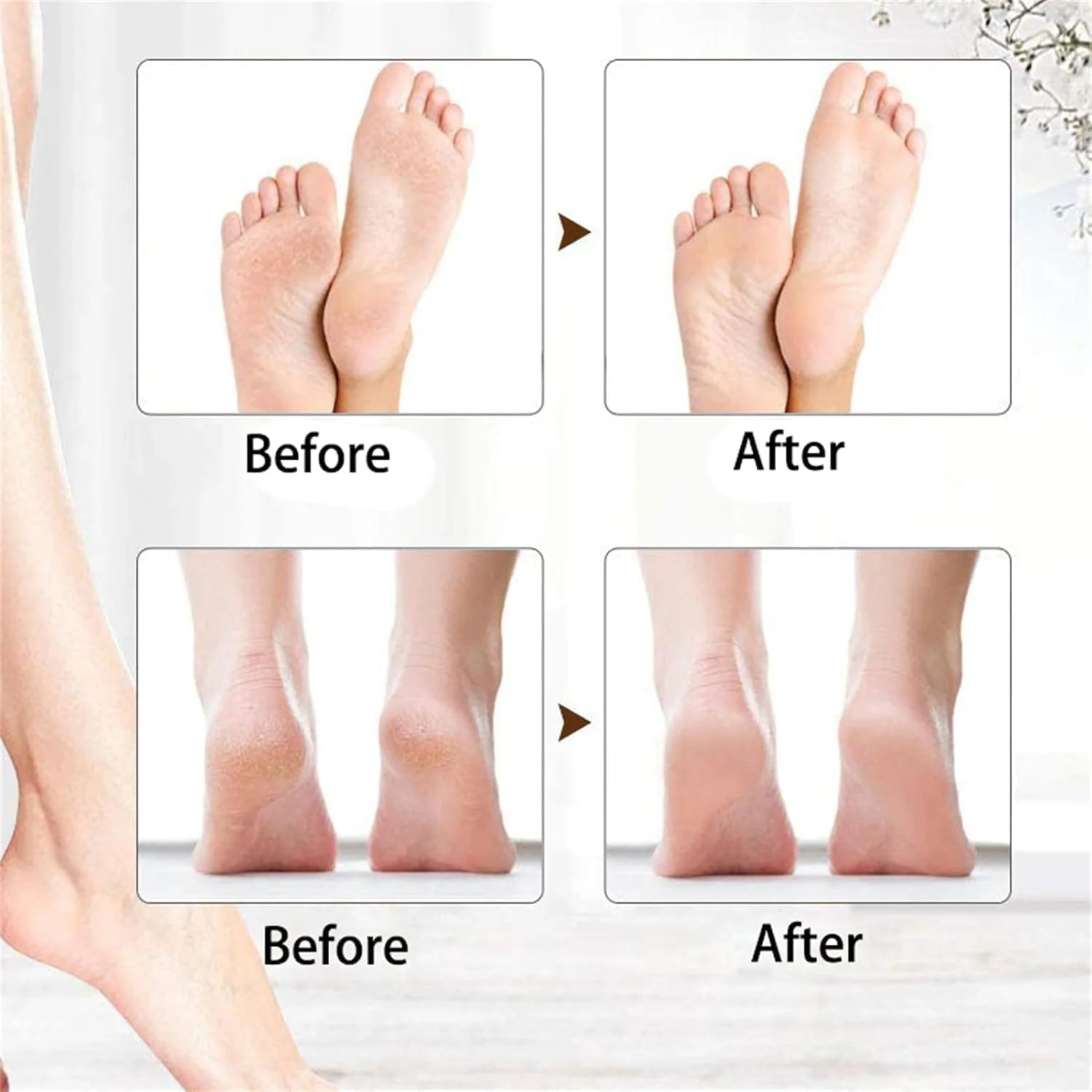 دستگاه سوهان برقی پدیکور پا Onwddarefy، پولیش برقی پا، 3 سرعت قابل تنظیم، چرخش 360 درجه، ابزار پدیکور قابل شارژ USB (سفید)