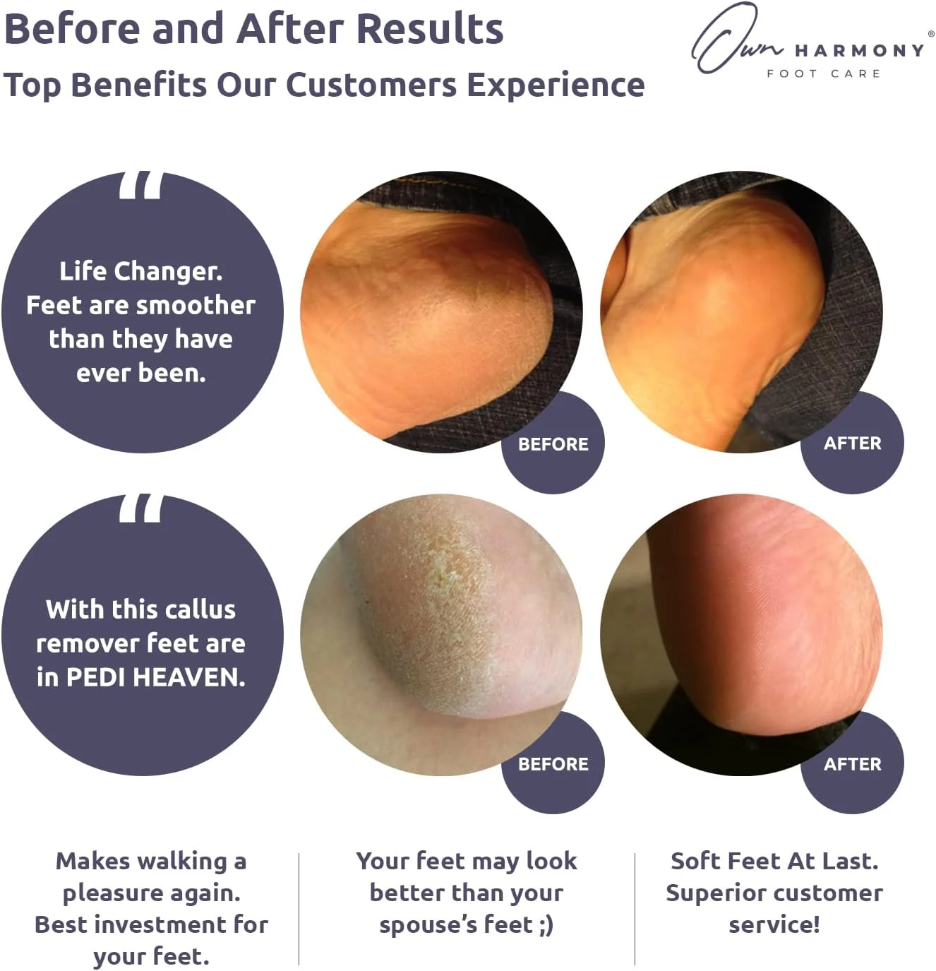 سوهان برقی شارژی از برند اون هارمونی برای از بین بردن پوست سفت: سوهان پدیکور حرفه ای - سمباده پا مدل CR1700 - موثر برای پینه و مراقبت از پاشنه های ترک خورده خشک (سیم USB)