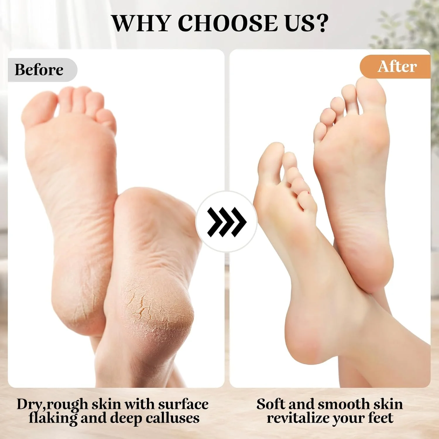 سوهان برقی پدیکور پا Nuaoi - ابزار پدیکور شارژی برای پا، 3 سری سمباده، 2 سرعت، نارنجی، پلاستیکی، سوهان