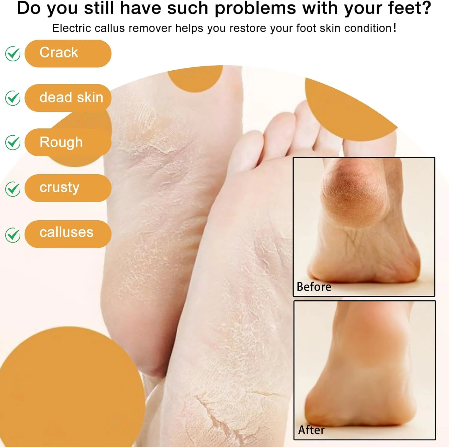 دستگاه سوهان برقی پا NUOKOU، دستگاه جدید تعمیر و ساییدن پا با قابلیت شارژ USB (آبی)