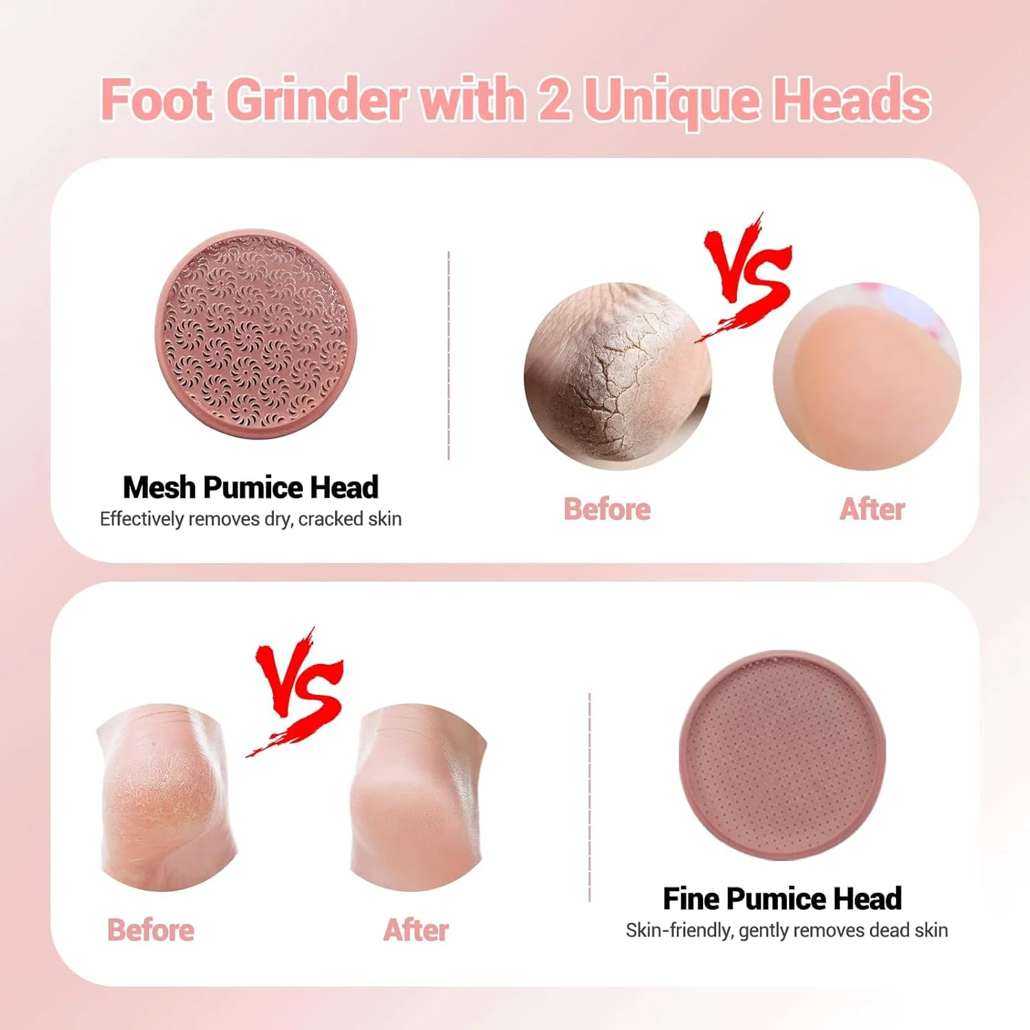 دستگاه الکتریکی از بین برنده پوست سفت نالاکال، از بین برنده پینه، از بین برنده پینه پا، اسکرابر برقی قابل حمل پا، سوهان برقی پا، پدیکور، 2 سر مختلف تعویضی