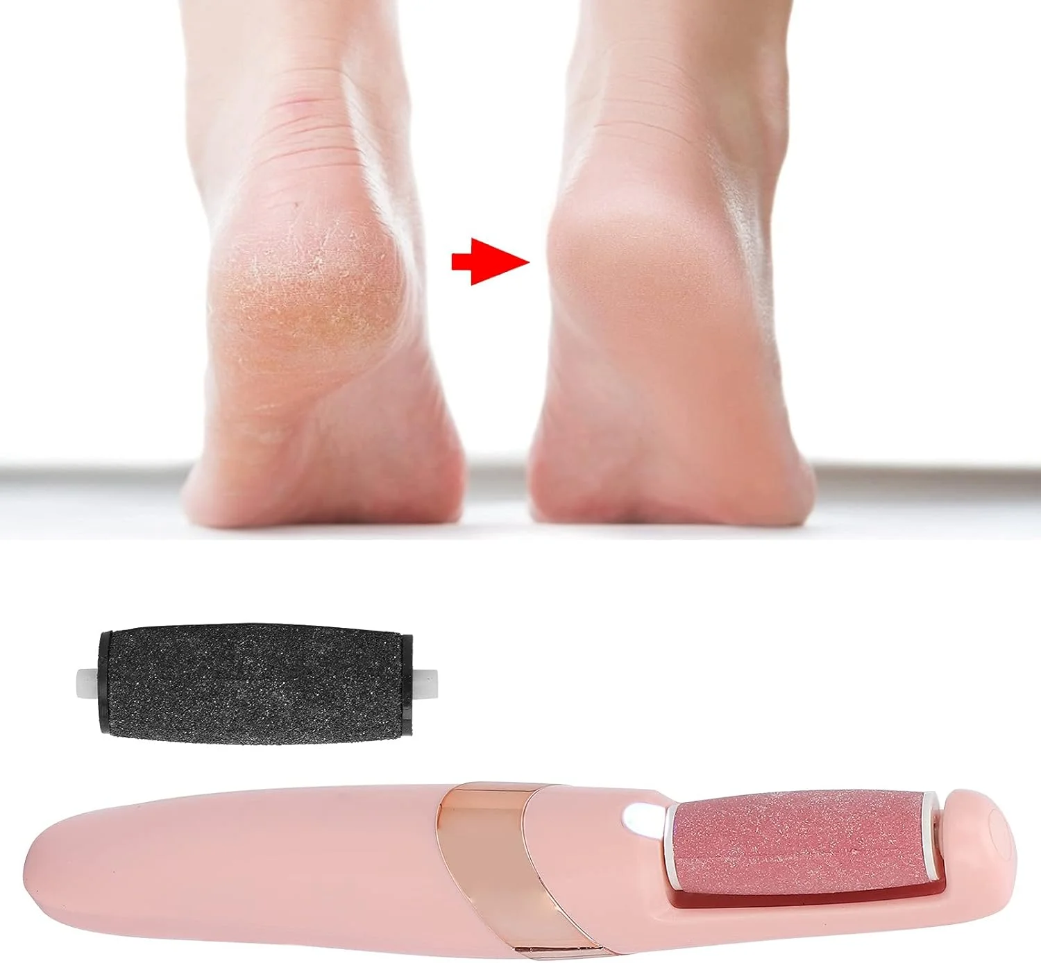 سوهان برقی پینه پا MXGZ، طراحی ارگونومیک دسته، ابزار مراقبت از پا برای داشتن پاهایی نرم سوهان برقی پینه پا MXGZ، طراحی ارگونومیک دسته، ابزار مراقبت از پا برای داشتن پاهایی نرم