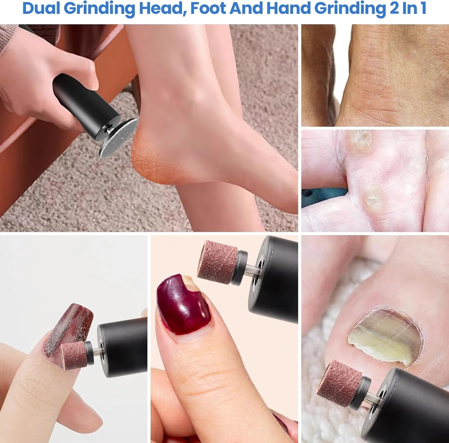 سوهان برقی پینه پا Mosthink، سوهان برقی ناخن و پا 2 در 1، ابزار حرفه ای پدیکور و سمباده پا برای پوست خشک و مرده به همراه دیسک سمباده، 6 سرعت قابل تنظیم سوهان برقی پینه پا Mosthink، سوهان برقی ناخن و پا 2 در 1، ابزار حرفه ای پدیکور و سمباده پا برای پوست خشک و مرده به همراه دیسک سمباده، 6 سرعت قابل تنظیم