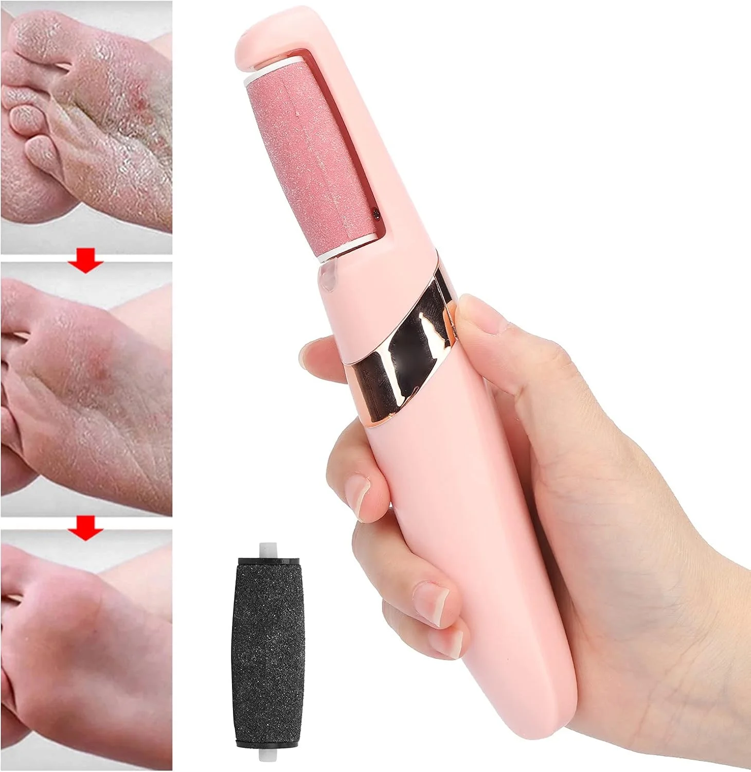 سوهان برقی پینه پا MXGZ، طراحی ارگونومیک دسته، ابزار مراقبت از پا برای داشتن پاهایی نرم سوهان برقی پینه پا MXGZ، طراحی ارگونومیک دسته، ابزار مراقبت از پا برای داشتن پاهایی نرم