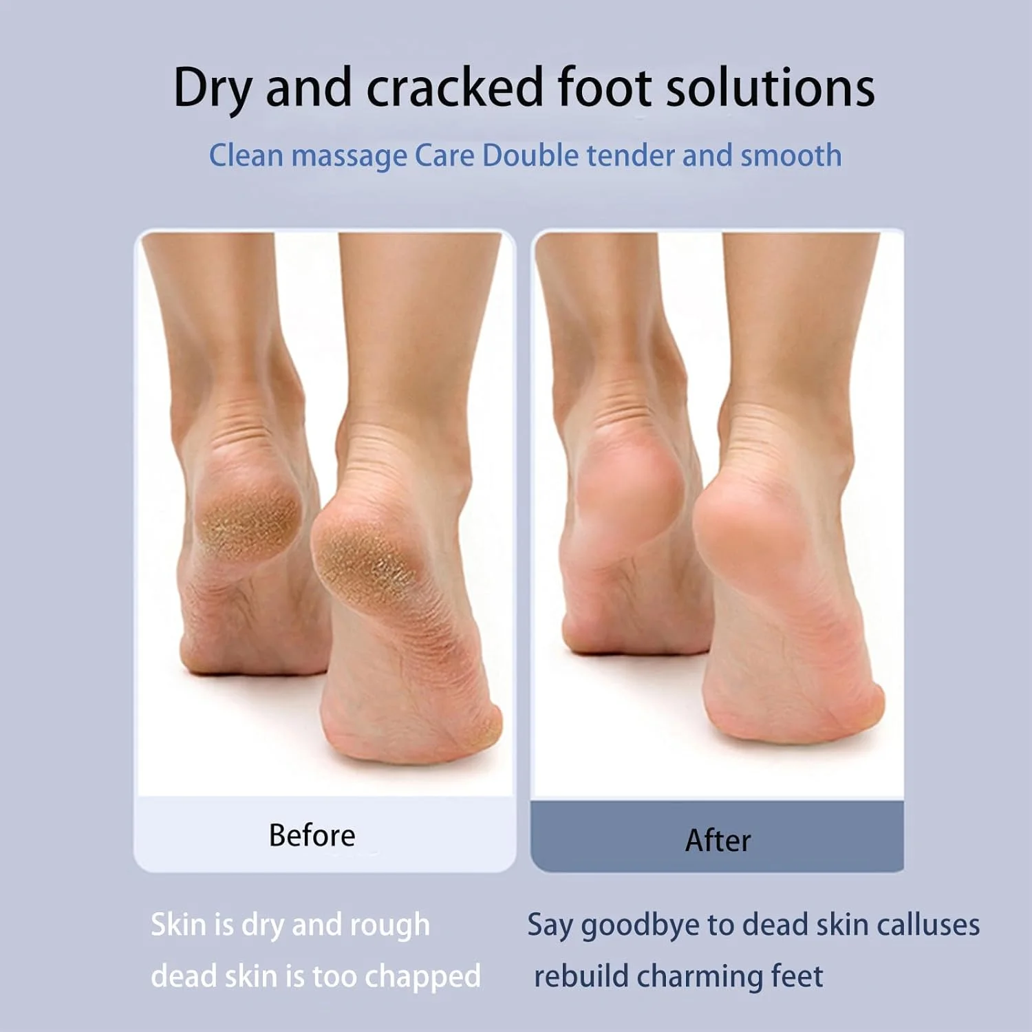 سوهان برقی پا Kequsprk، دستگاه از بین برنده پینه پا با 3 سری قابل تعویض، 1 برس تمیز کننده و سیم USB برای از بین بردن پینه، پوست مرده، سفت و خشک ترک خورده سوهان برقی پا Kequsprk، دستگاه از بین برنده پینه پا با 3 سری قابل تعویض، 1 برس تمیز کننده و سیم USB برای از بین بردن پینه، پوست مرده، سفت و خشک ترک خورده