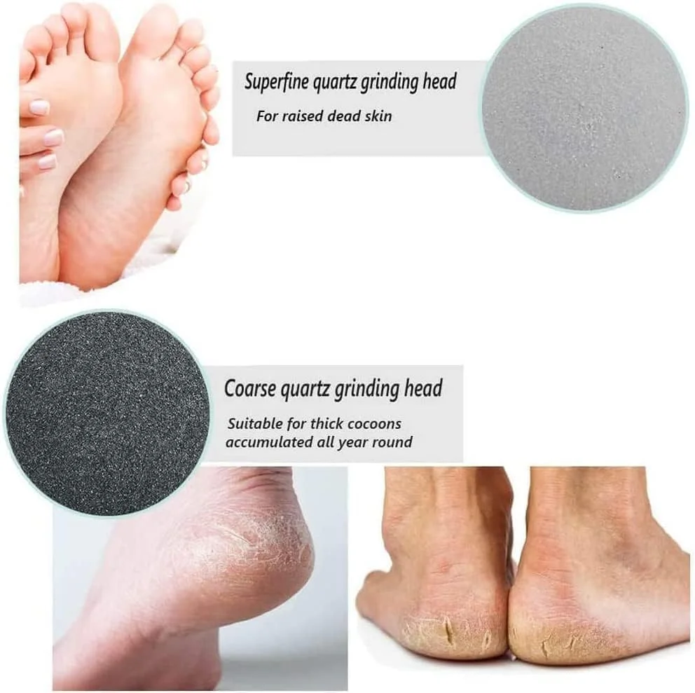 سوهان برقی پا از بین برنده پینه، پاهایی نرم و لطیف در عرض چند دقیقه سوهان برقی پا از بین برنده پینه، پاهایی نرم و لطیف در عرض چند دقیقه