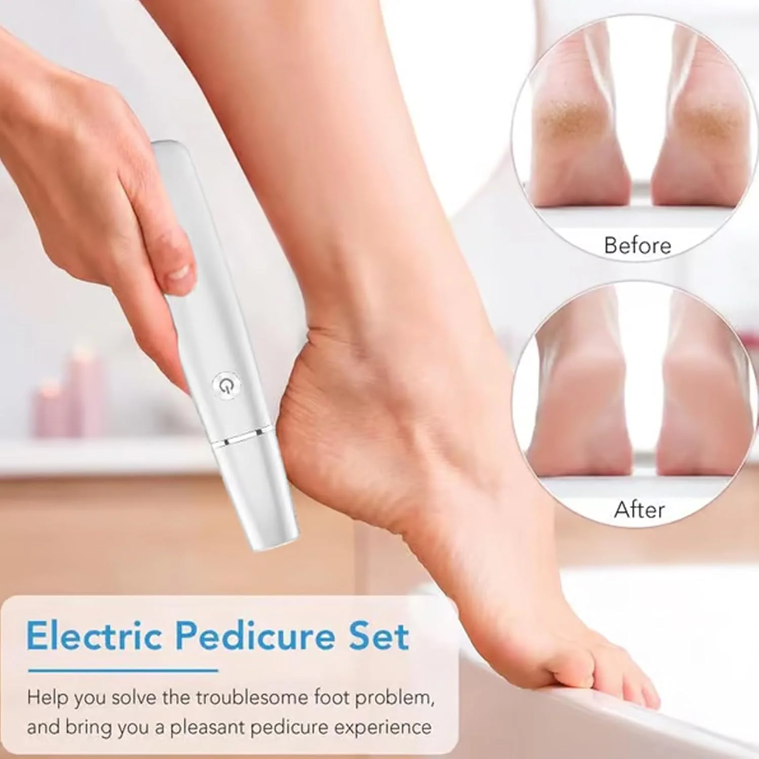 سوهان برقی پدیکور پا GraGra، از بین برنده پوست سفت، ابزار جدید چند منظوره مراقبت از پا، پدیکور قوی برای پوست خشک و مرده، پینه های پاشنه ترک خورده (سفید)