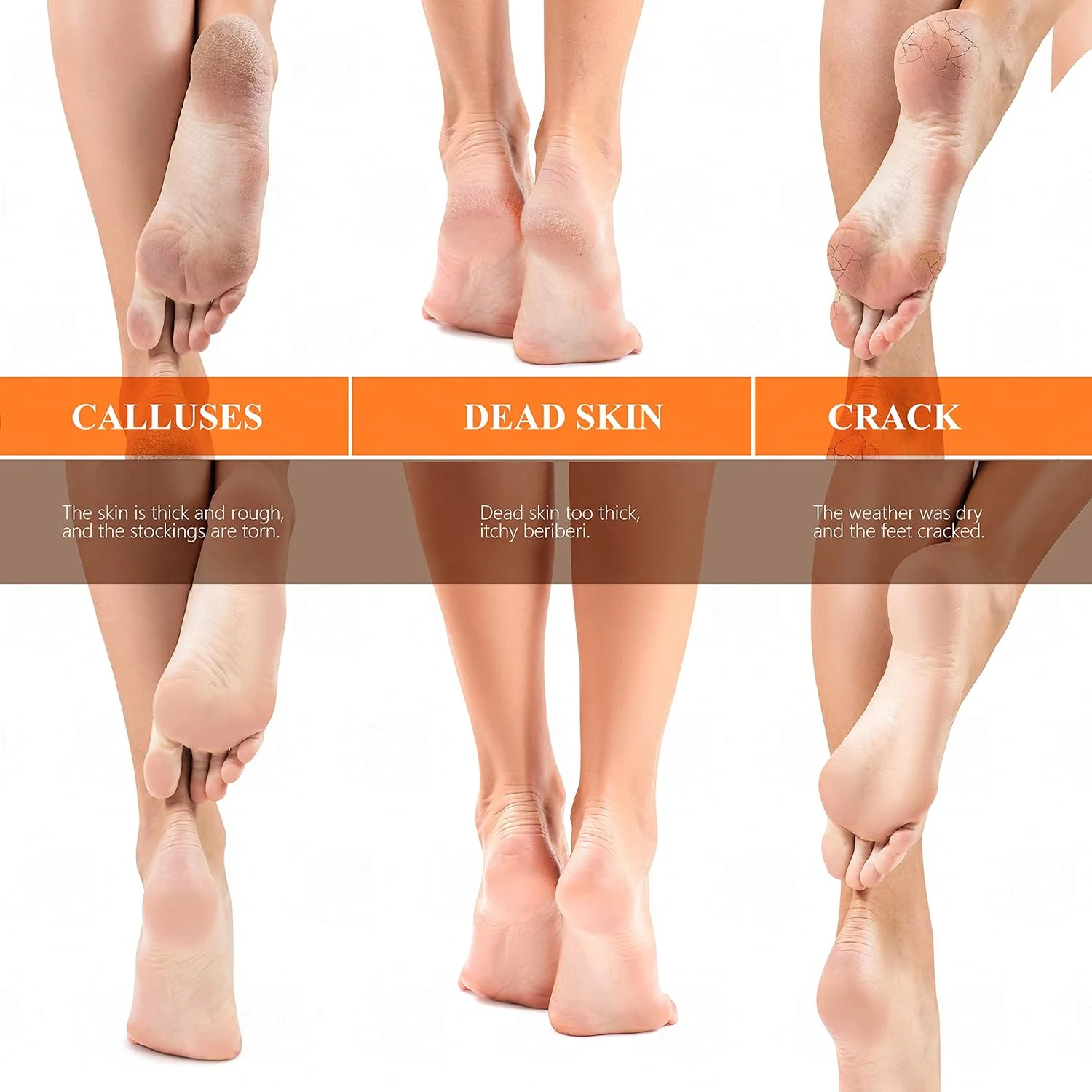 سوهان پا نانو فوتون مدل 2021، ابزار پدیکور مراقبت از پا، سوهان پا با نقاط سنگ زنی نانو، عالی برای از بین بردن پوست مرده، لایه برداری، پاهای خیس و خشک (تخم مرغی)