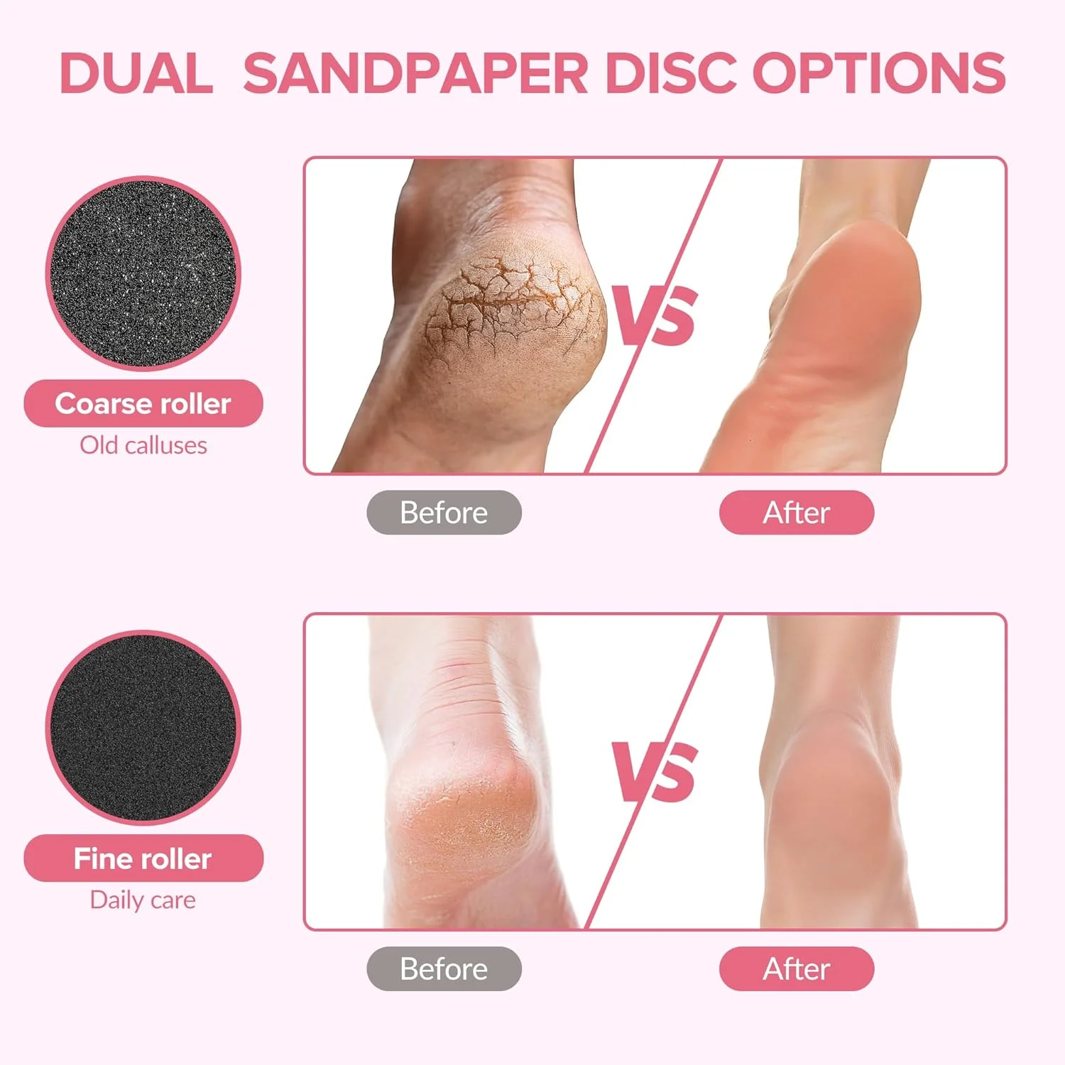 سوهان برقی پا، ابزار مراقبت از پا، آسیاب شارژی با سرعت متغیر با 60 دیسک سمباده، ابزار حرفه ای پدیکور برای از بین بردن پینه، پوست خشک و ترک خورده - صورتی 008