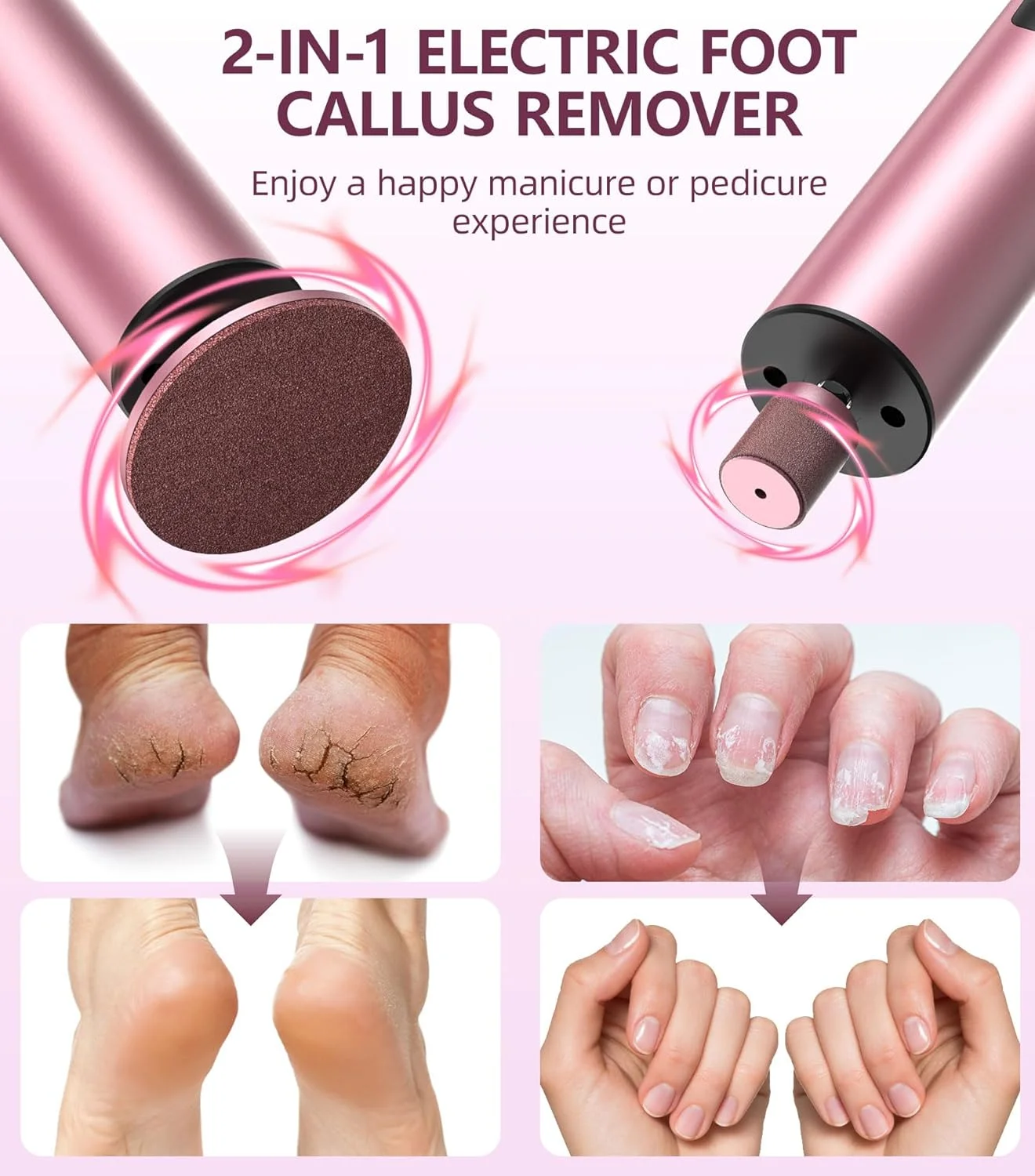 دستگاه سوهان برقی پدیکور و مانیکور ERYUHAIAN، سوهان برقی پا و سوهان ناخن 2 در 1، دستگاه سوهان پا شارژی، سمباده برقی حرفه ای پا برای از بین بردن پوست مرده، 6 سرعت قابل تنظیم - صورتی