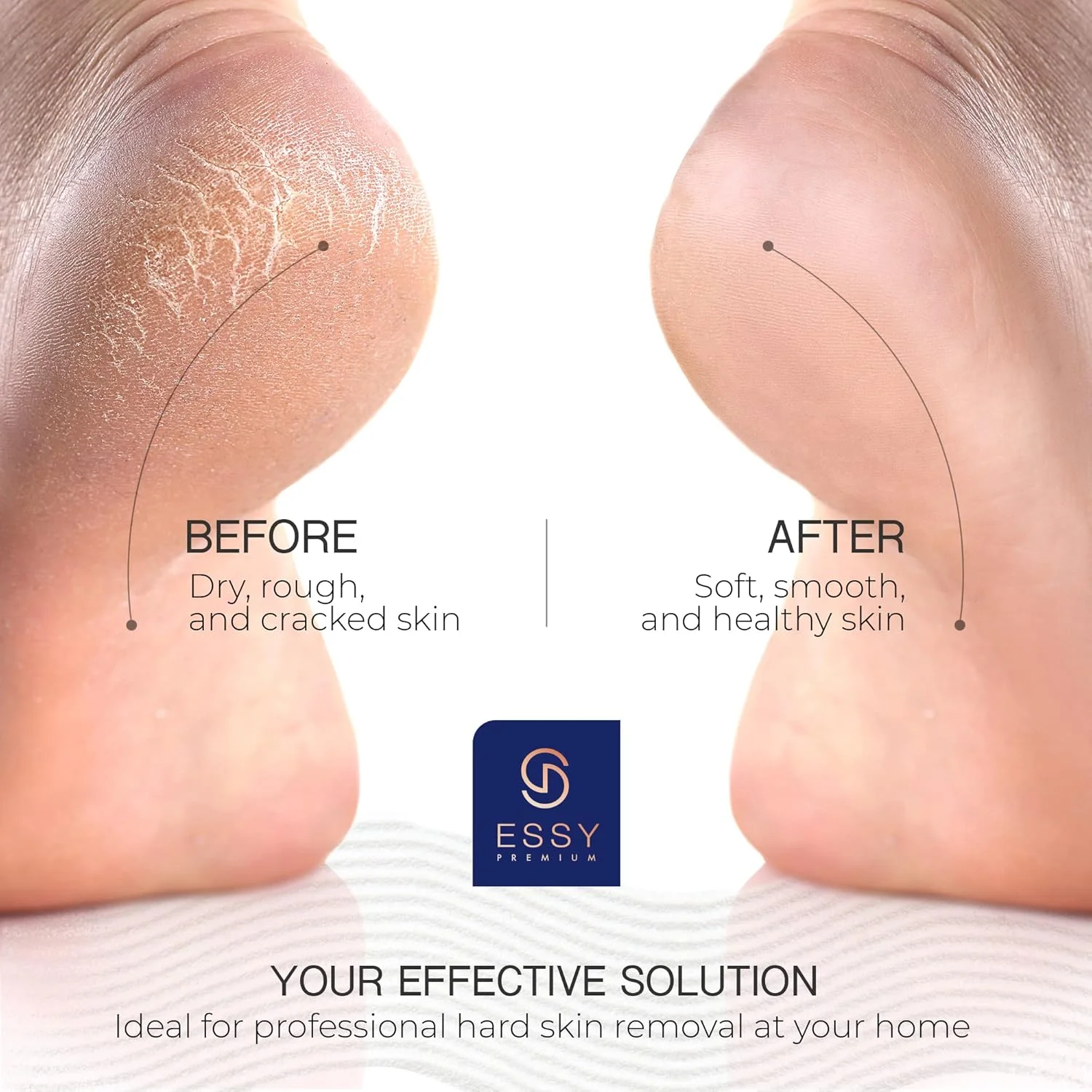 سوهان برقی پا Essy، از بین برنده پینه پا، سوهان برقی پا برای از بین بردن پوست مرده، ابزار از بین برنده پینه پا، پدیکور برقی (آبی تیره)