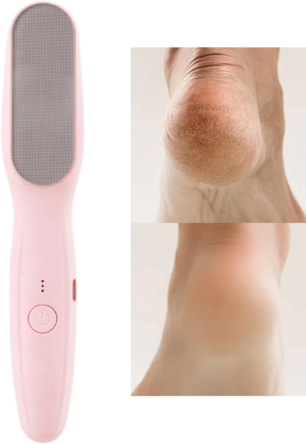 سوهان برقی پا، دستگاه برقی ارتقا یافته از بین برنده پینه پا، دستگاه های ضد آب مراقبت از پا با سرعت قابل تنظیم مجموعه پدیکور برای استفاده روزانه آرایشگاه خانگی مسافرت پوست مرده