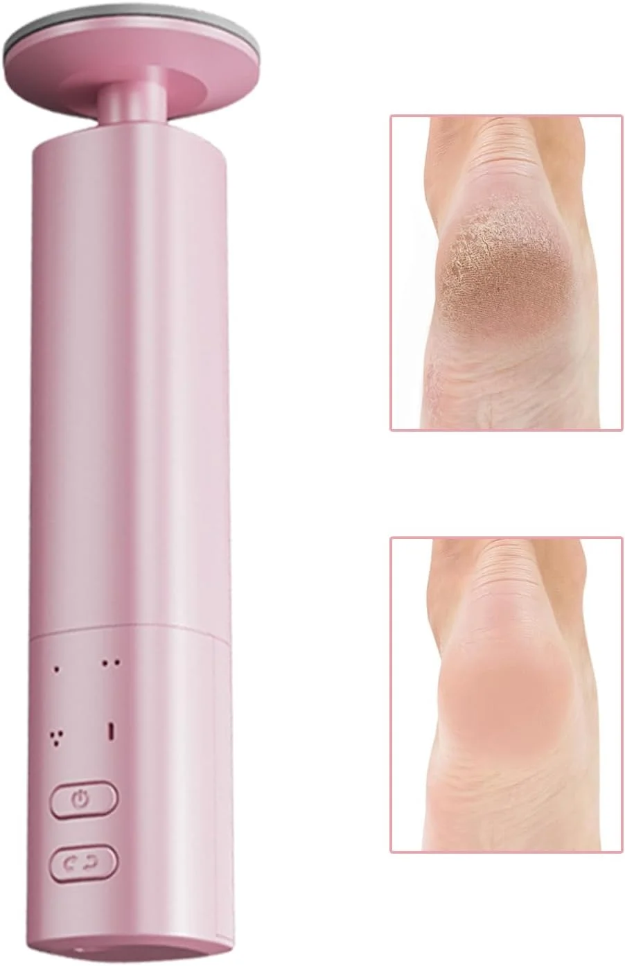 سوهان برقی پا، از بین برنده پوست مرده پا، اسکرابر پدیکور قابل شارژ برای آماده سازی پا برای صندل و اسپا