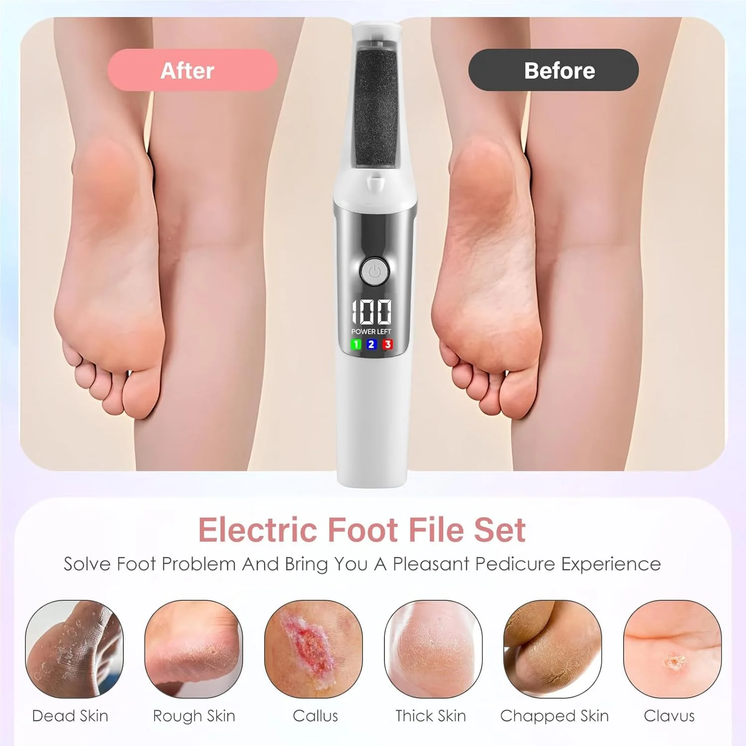 Electric Foot Scrubber, 10-in-1Rechargeable Callus Remover For Feet, Pedicure Tool with 3 Rollers & 3 Speeds Foot Scrubber, Professional Dead Skin Remover for Smooth Feet Electric Callus Remover Kit