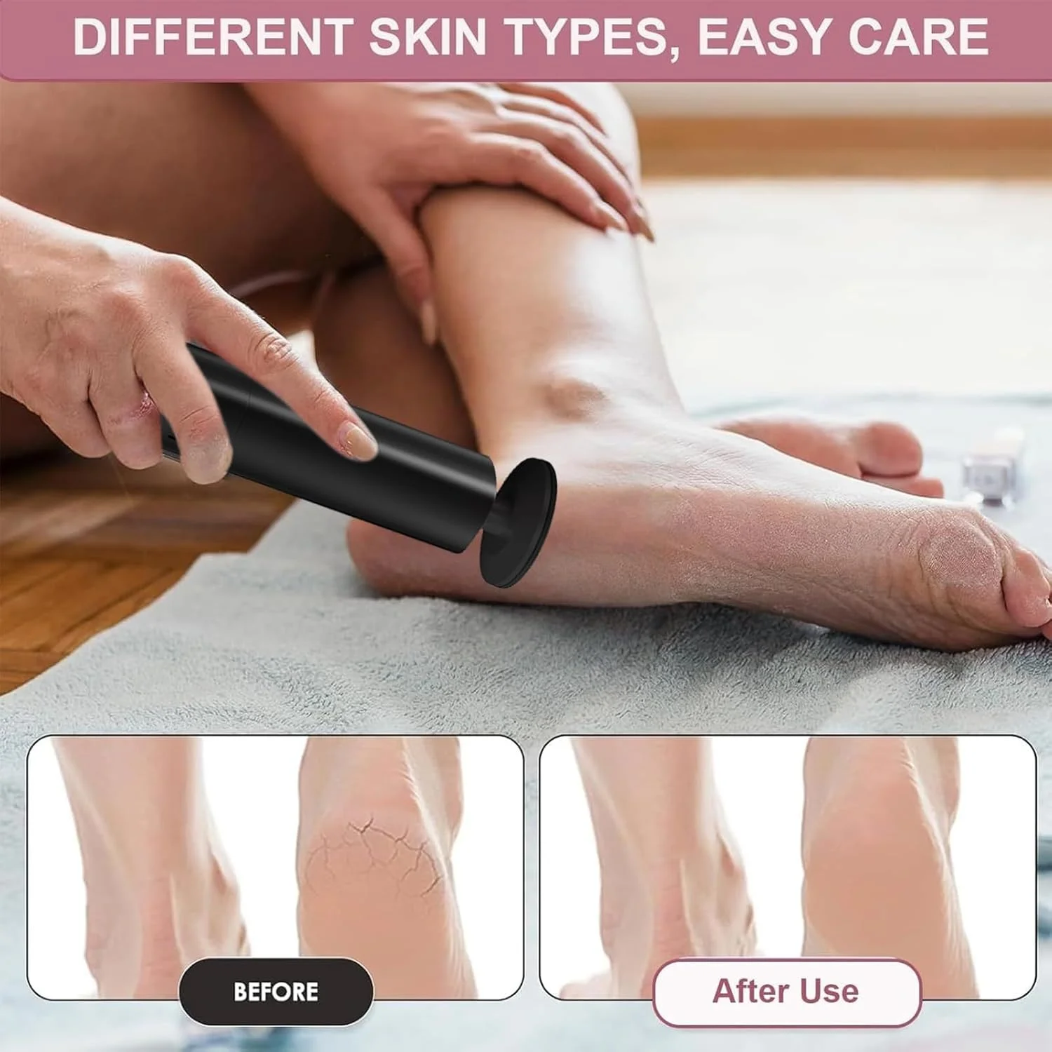 سوهان برقی پا | از بین برنده پوست مرده پا، سوهان پدیکور شارژی با سرهای قابل تعویض برای مسافرت، اسپا، داخل خانه