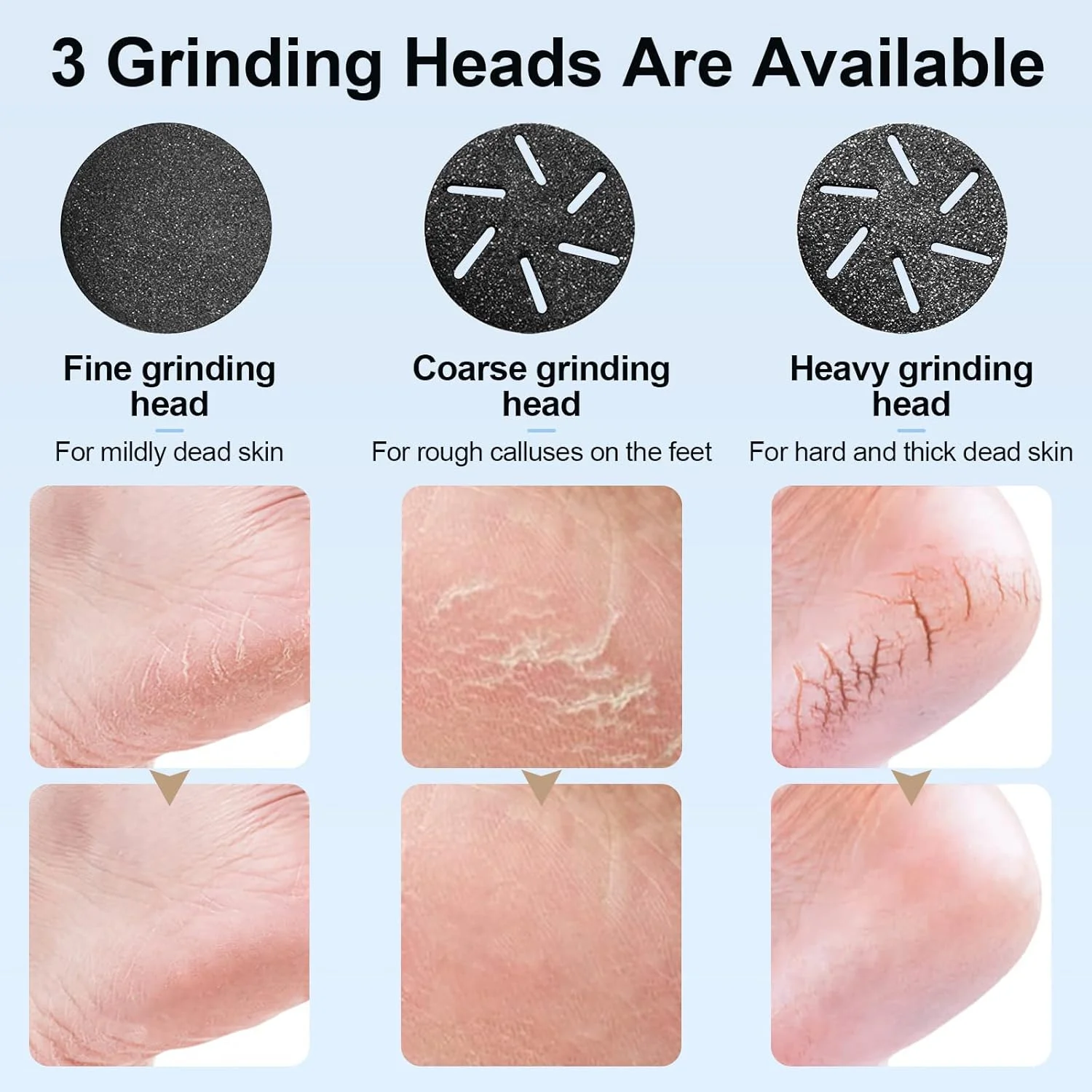 دستگاه الکتریکی از بین برنده پینه پا با جاروبرقی مکنده پوست مرده، ابزار پدیکور قابل شارژ، کیت مراقبت حرفه ای پا، سوهان پا از بین برنده پوست مرده با 3 سری و 2 سرعت، نمایشگر LCD