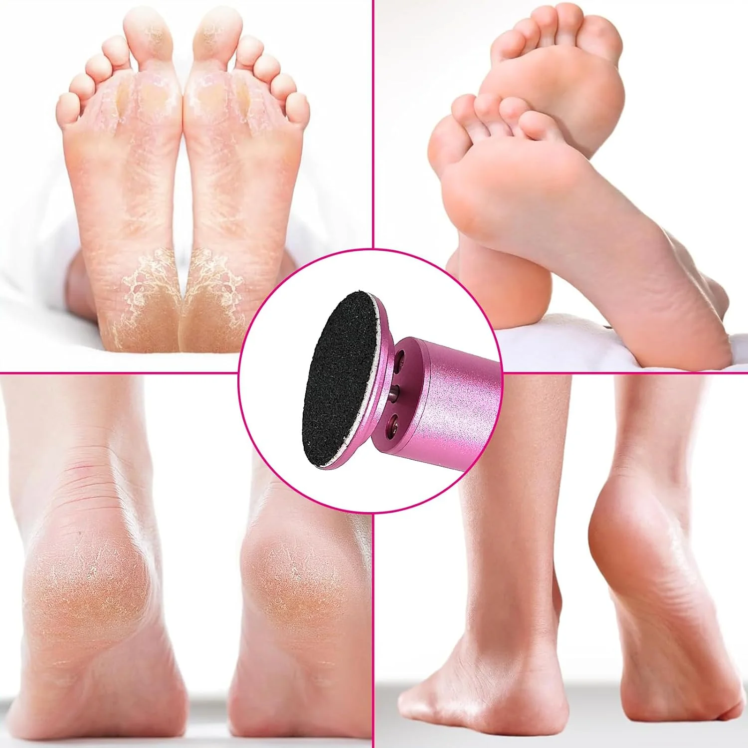 سوهان برقی پا، ابزار حرفه ای پدیکور با 60 کاغذ سمباده، صورتی