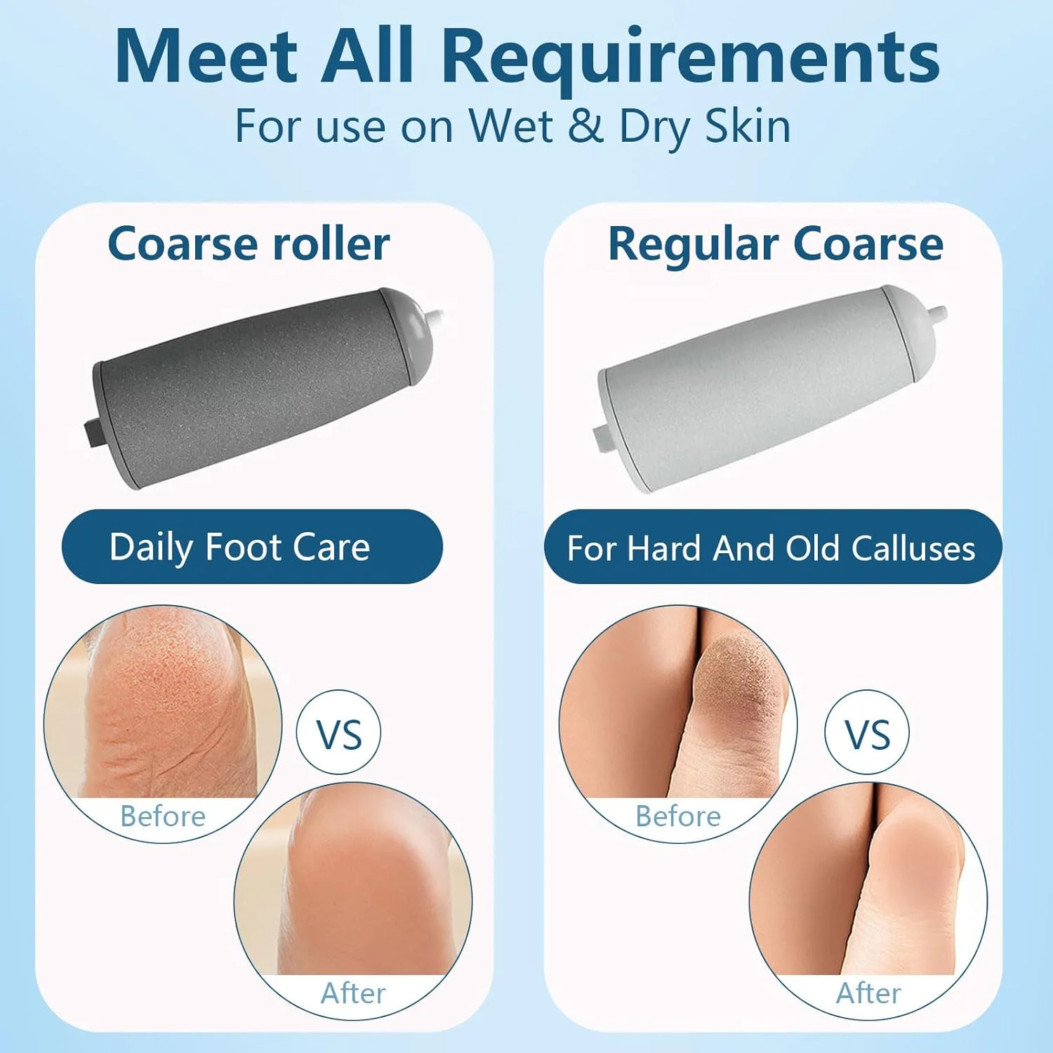 سوهان برقی پدیکور پا، سوهان برقی از بین برنده پینه پا، سمباده برقی پا، لایه بردار شارژی پا، ست پدیکور قوی برای پوست های مرده، ضخیم و پاشنه های ترک خورده