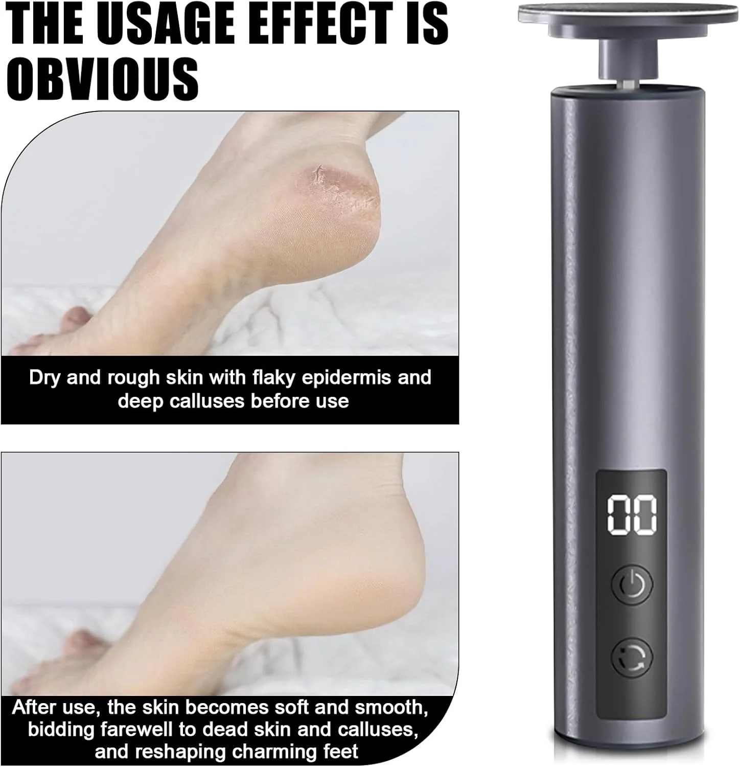 سوهان برقی پینه پا 2 در 1، ست مانیکور برقی، نرم کننده پا، ست سوهان برقی پا، سوهان پا قابل شارژ برای پاشنه های ترک خورده، پینه و پوست مرده