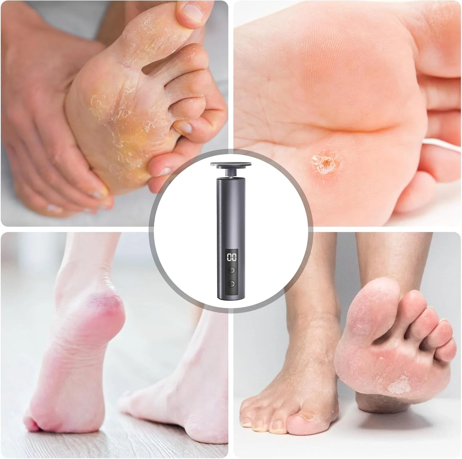سوهان برقی پینه پا 2 در 1، ست مانیکور برقی، نرم کننده پا، ست سوهان برقی پا، سوهان پا قابل شارژ برای پاشنه های ترک خورده، پینه و پوست مرده